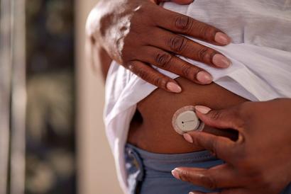 Frau platziert Dexcom G7-Sensor auf ihrem Bauch