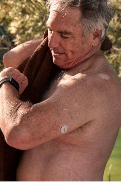 Starší muž sa suší uterákom so senzorom Dexcom G7 na ramene