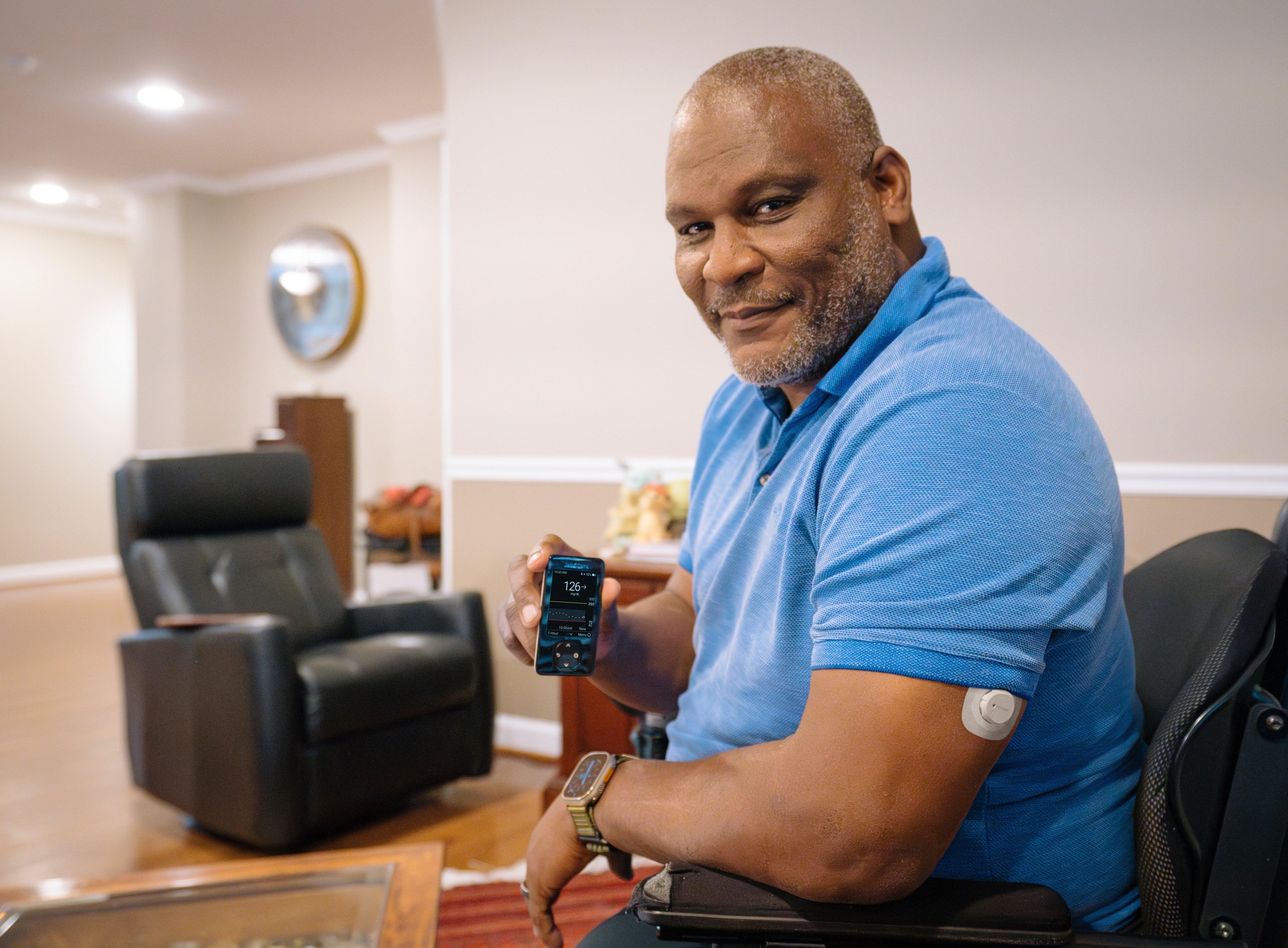 Greg G wearing the G7 sensor on his arm