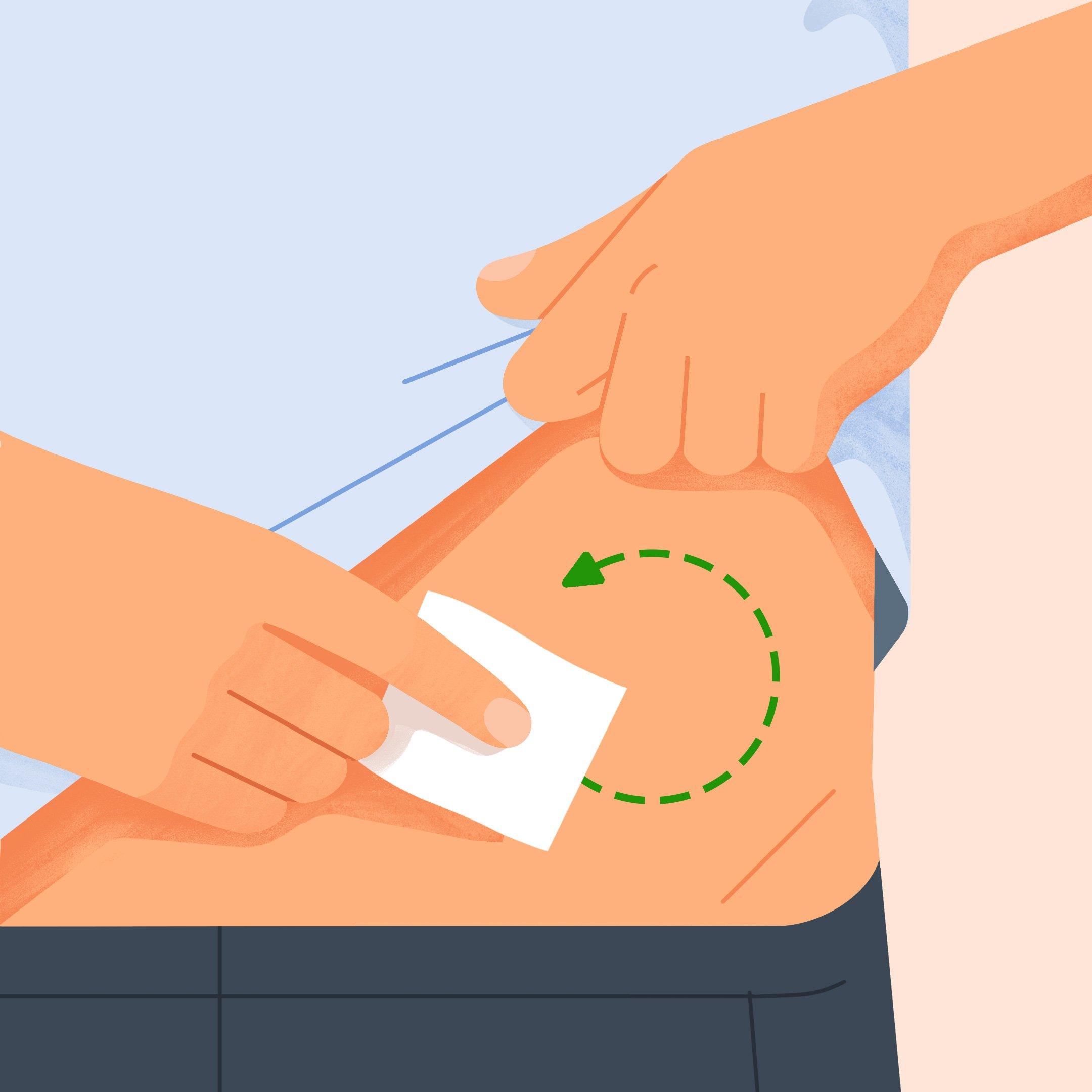 Diagram of Dexcom CGM Diabetic Patch