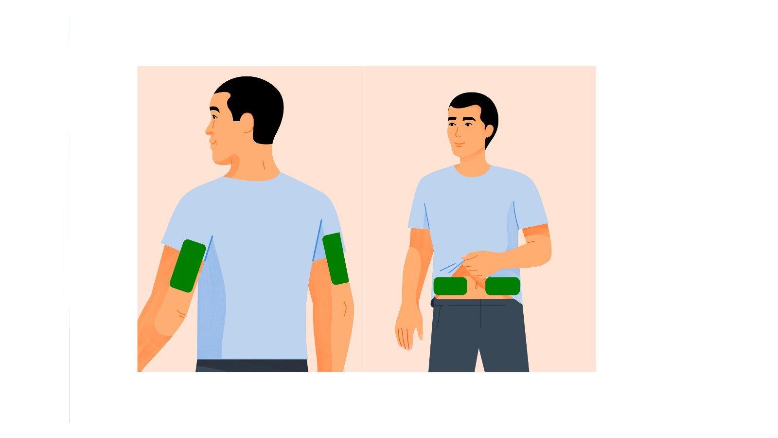 上腕と腹部にセンサーを装着している患者