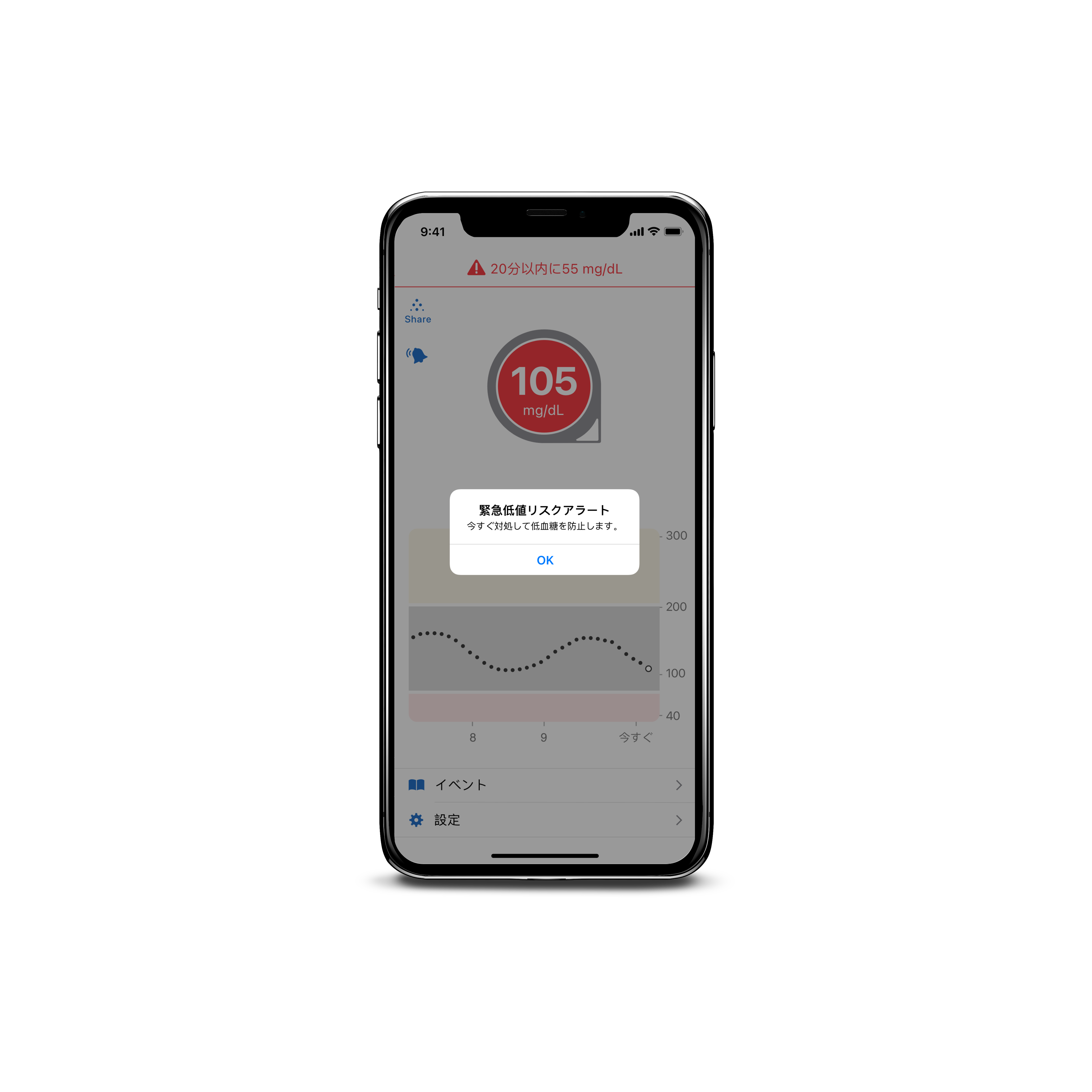 Dexcom G6 CGM alerts provide a 20 minute advance warning