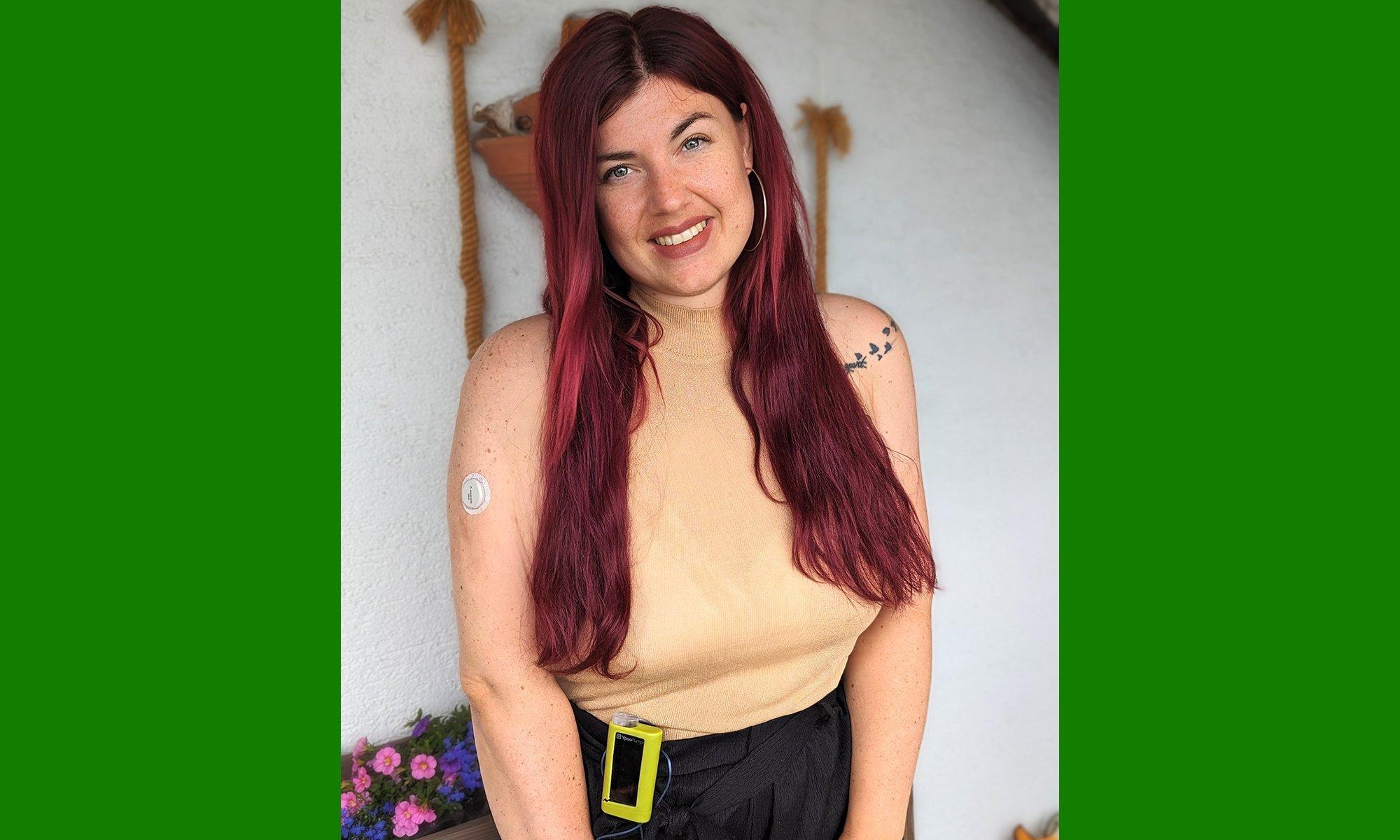 Woman with red hair and Ypsopump smiling in the camera.