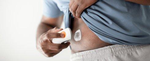 Dexcom G6 diabetes sensor can be worn on abdomen