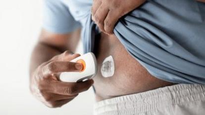 Dexcom G6 diabetes sensor can be worn on abdomen