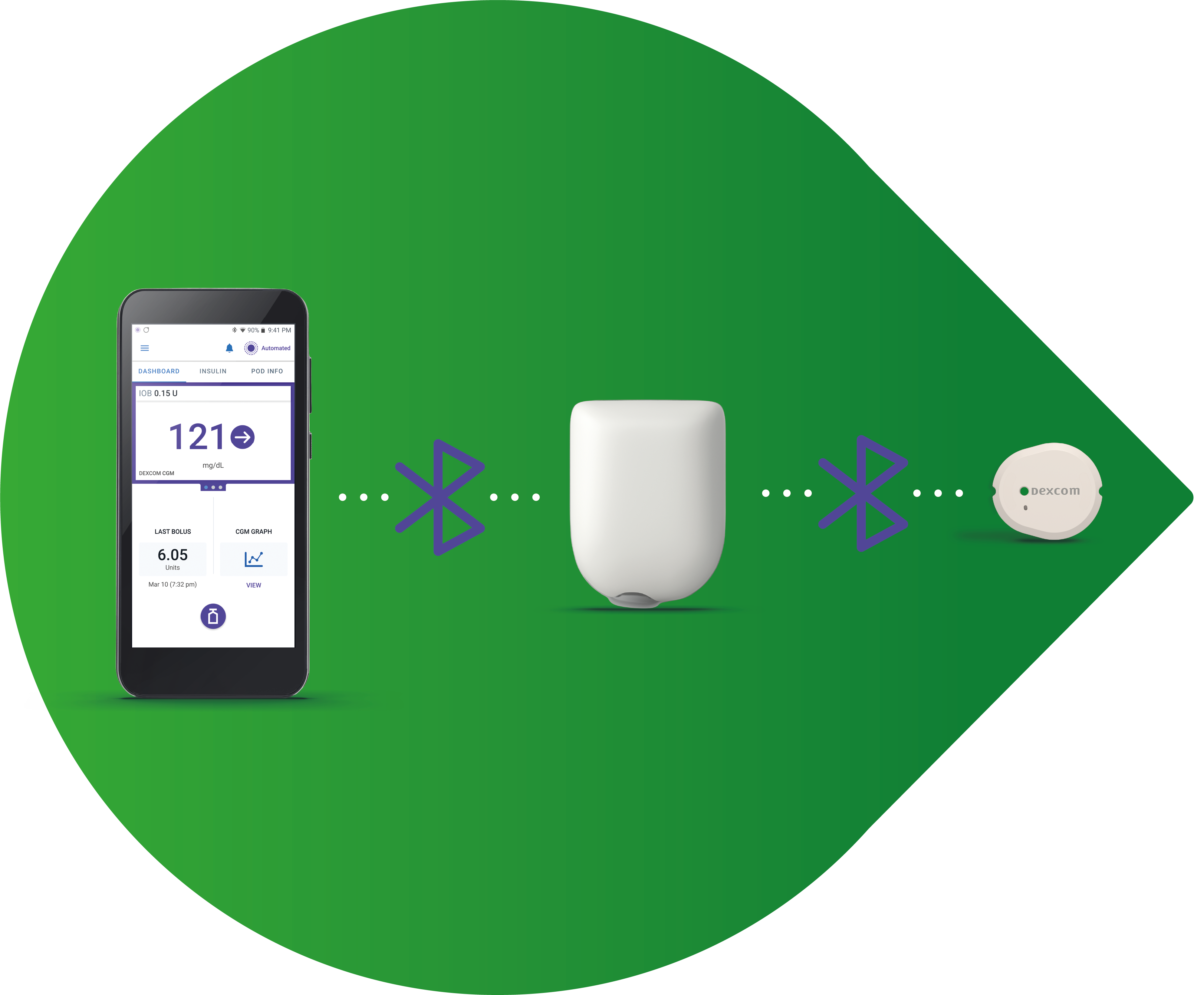Automatisierte Insulindosierung mit Dexcom G7 und Omnipod 5