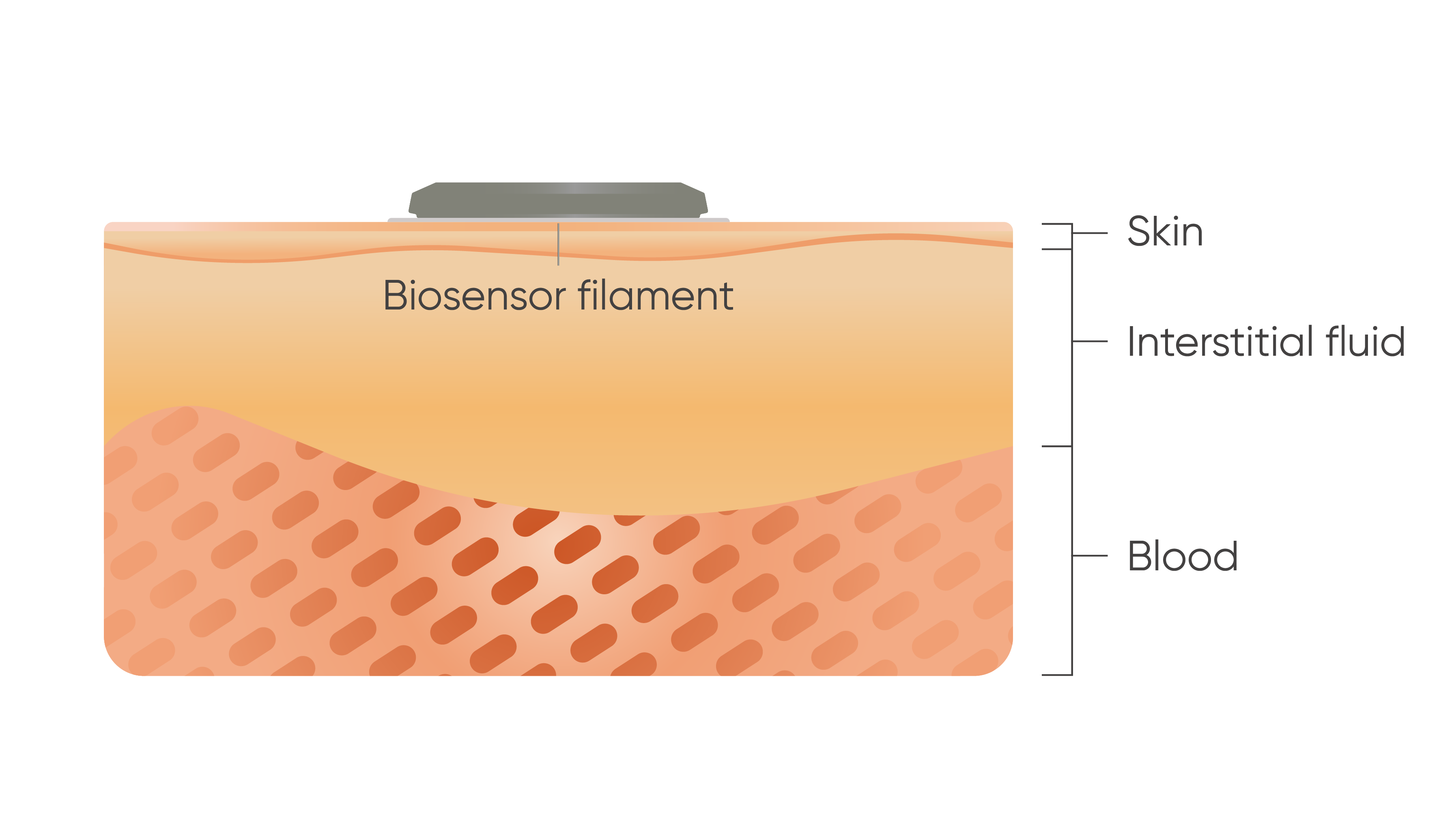 Illustration of Stelo biosensor on top of skin, interstitial fluid, and blood.