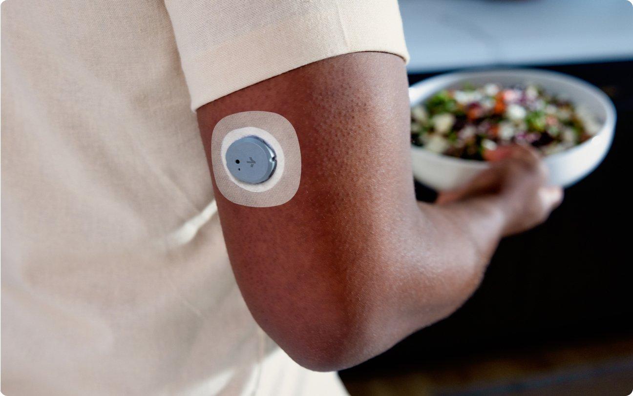 Stelo sensor and overpatch on arm