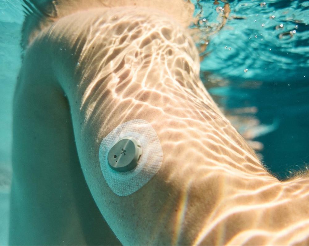 arm wearing stelo glucose biosensor underwater while swimming