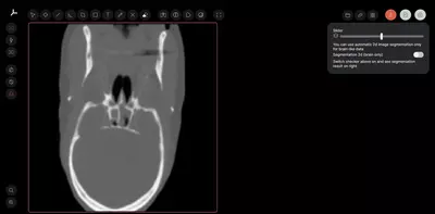 MRIViewer