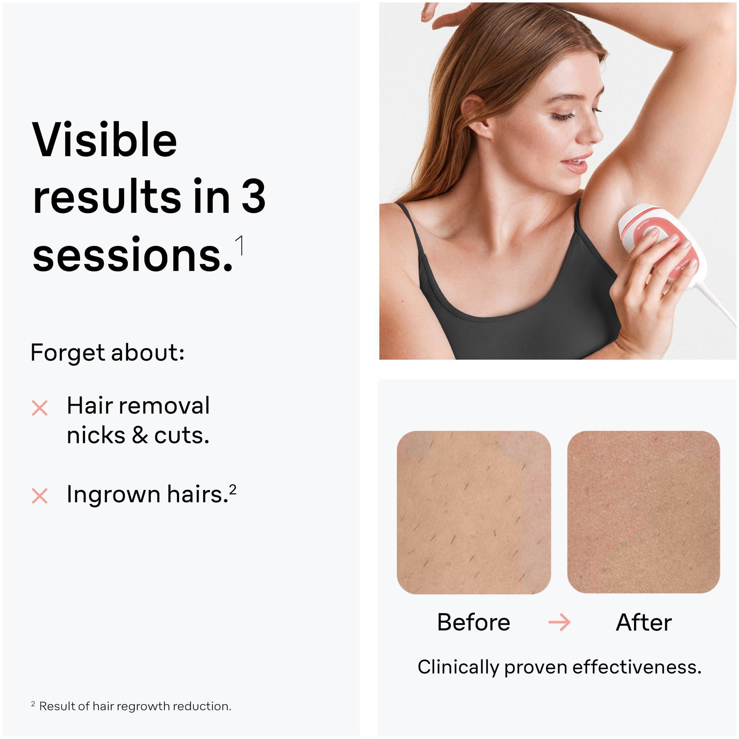 Pink - Braun - Braun PL1014 Silk-Expert Mini IPL Hair Removal - 5