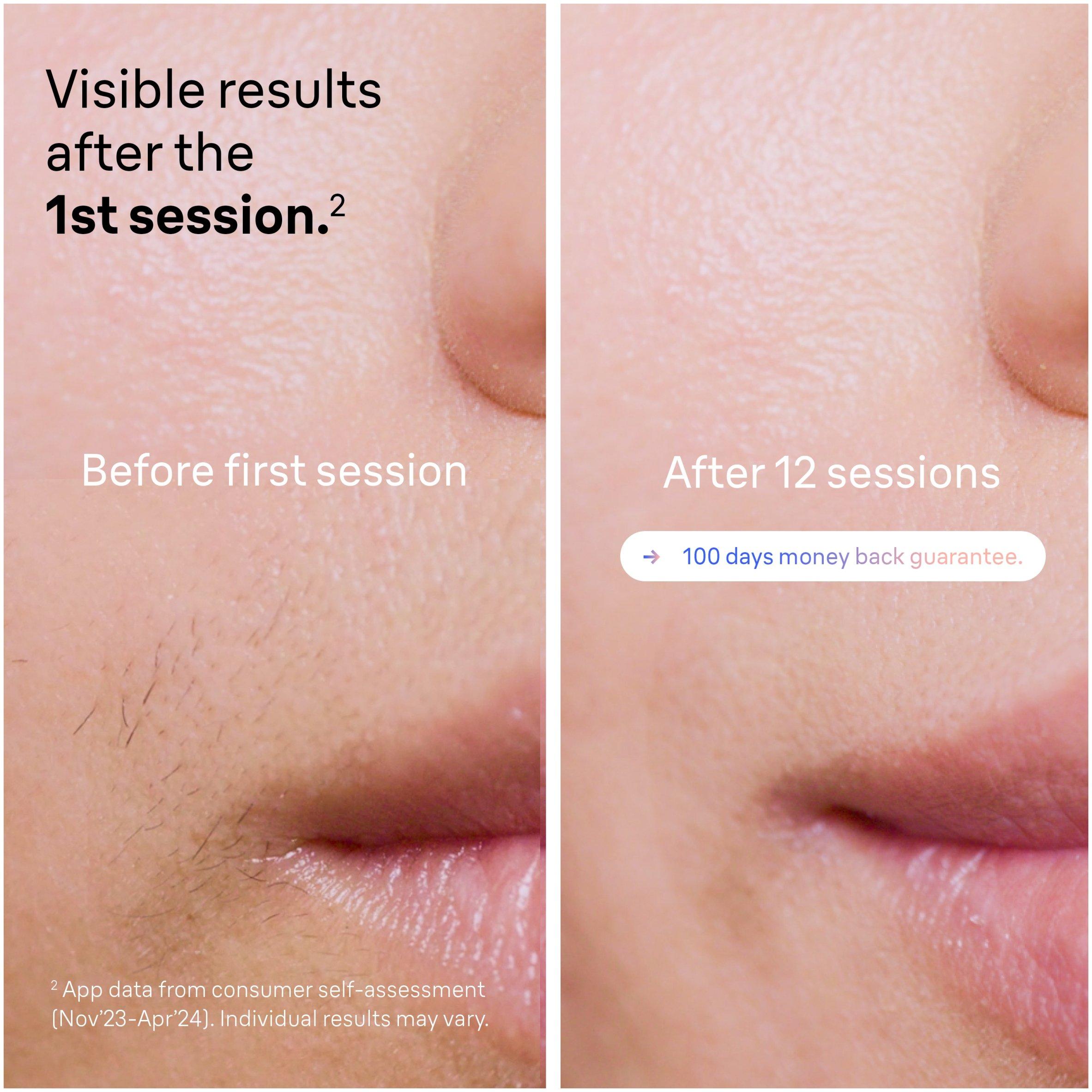 White - Braun - Braun IPL Silk-Expert PL7387 - 7