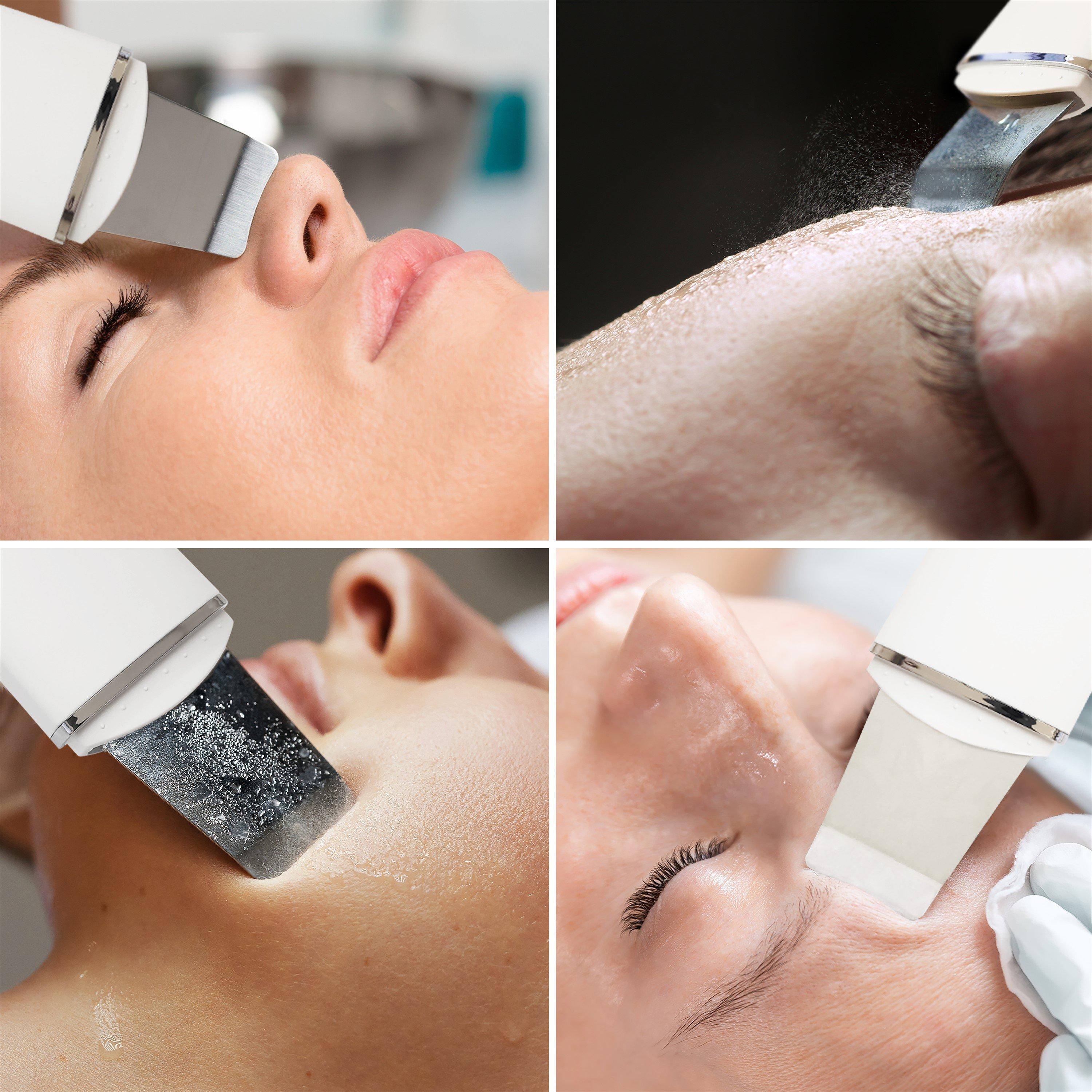 White - Rio - Ultrasonic Facial Skin Cleanser - 6