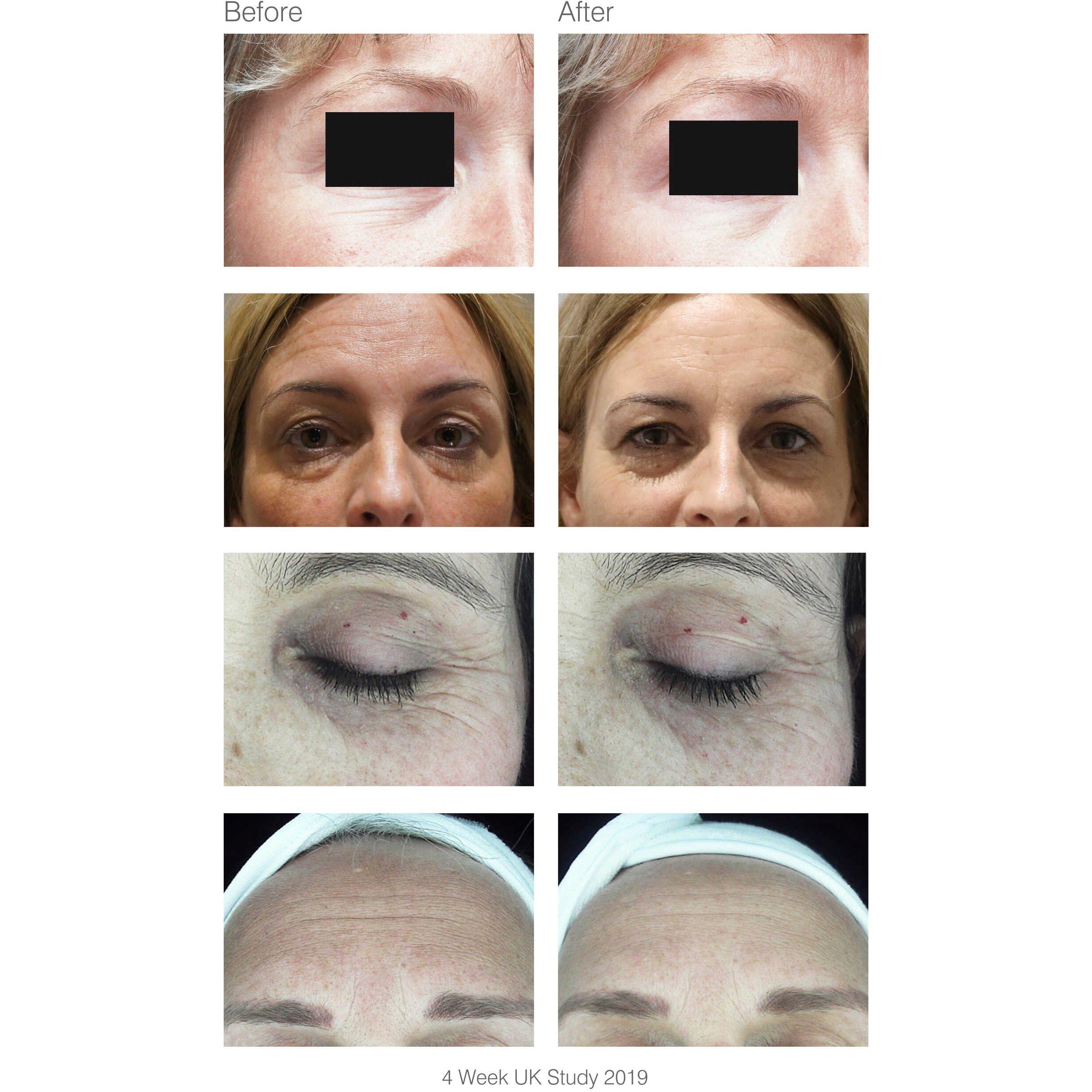 White - Rio - Rio faceLITE beauty boosting LED face mask - 6