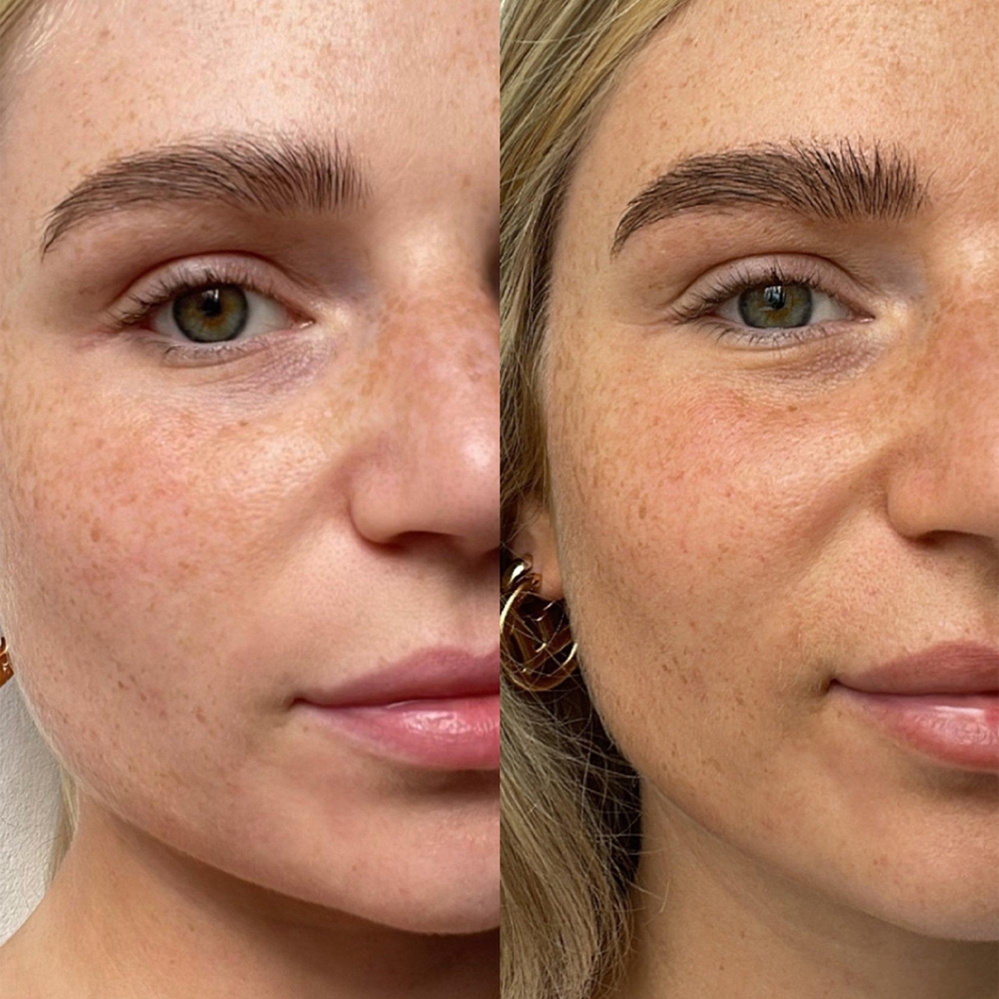 Light/Medium - Tan Luxe - THE FACE ANTI-AGE - 4
