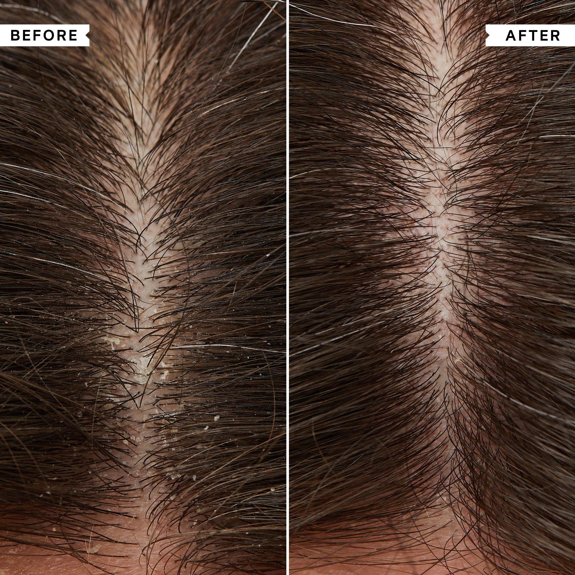 None - Philip Kingsley - Flaky/Itchy Scalp Shampoo and Conditioner Duo - 3