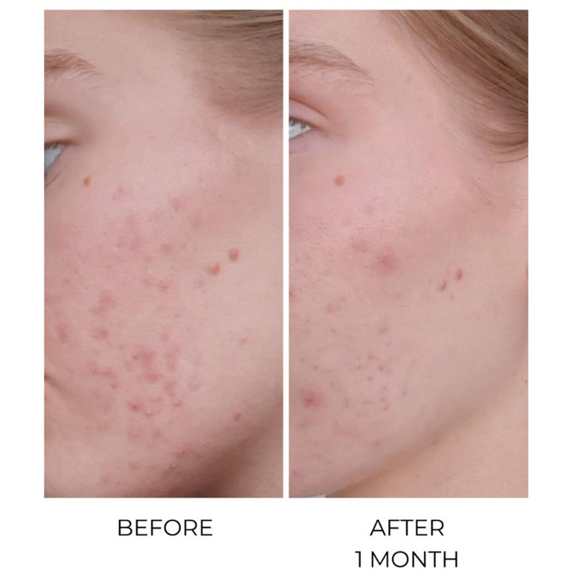 None - Oskia - MSM Bio-Plus - 2
