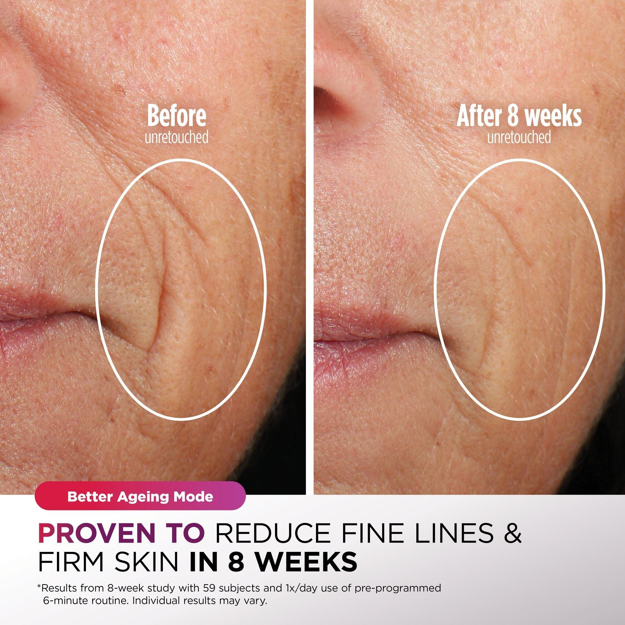 Sage Green - Shark - CryoGlow Mask FW312UKSG Sage Green - 6