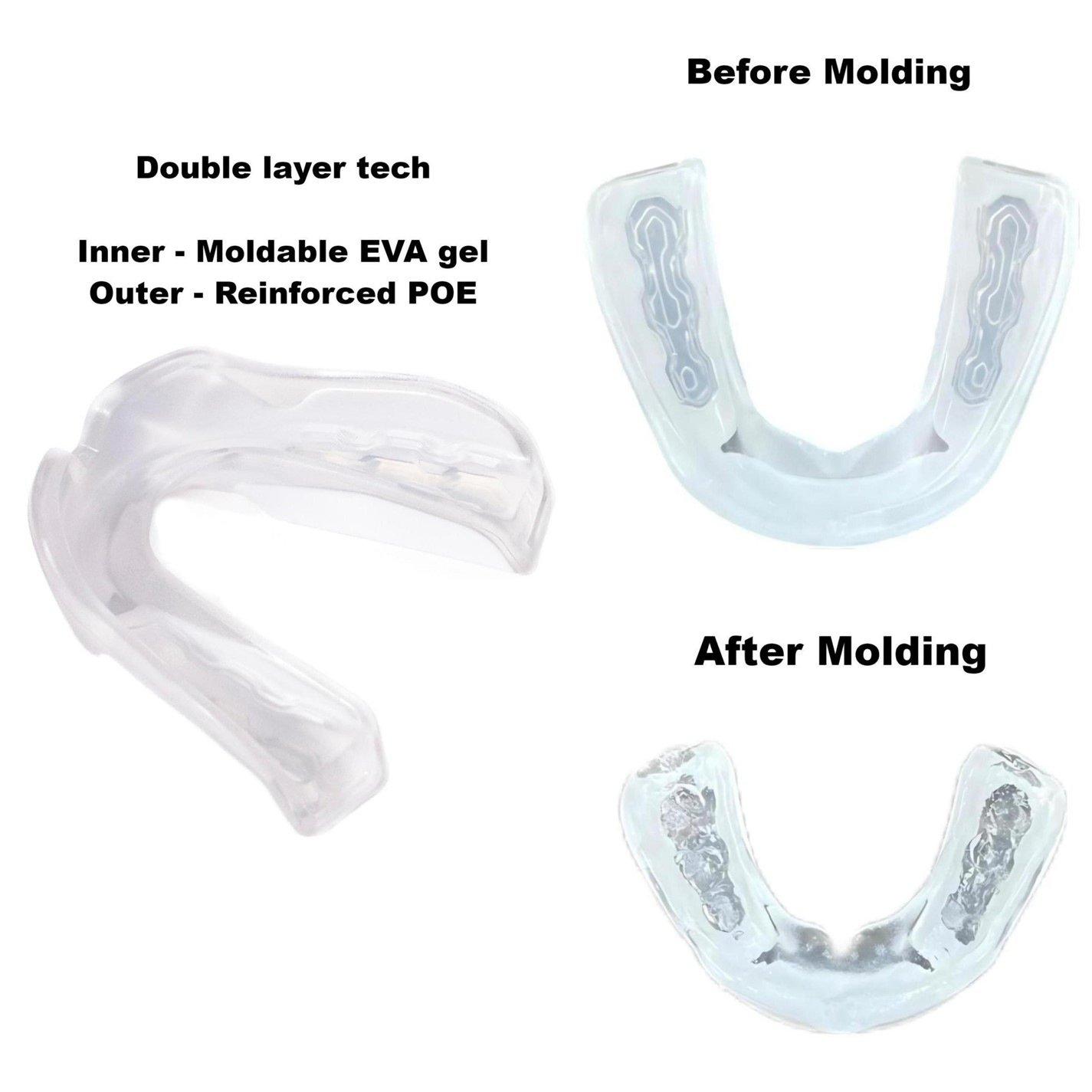 Branco - KooGa - Ergo Fit Gel Mouthguard - 5