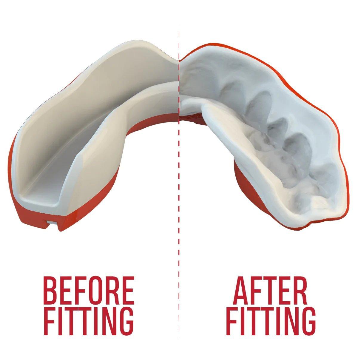 Rot/Weiß - Safejawz - Extro Series Viper Sports Mouthguard - 4