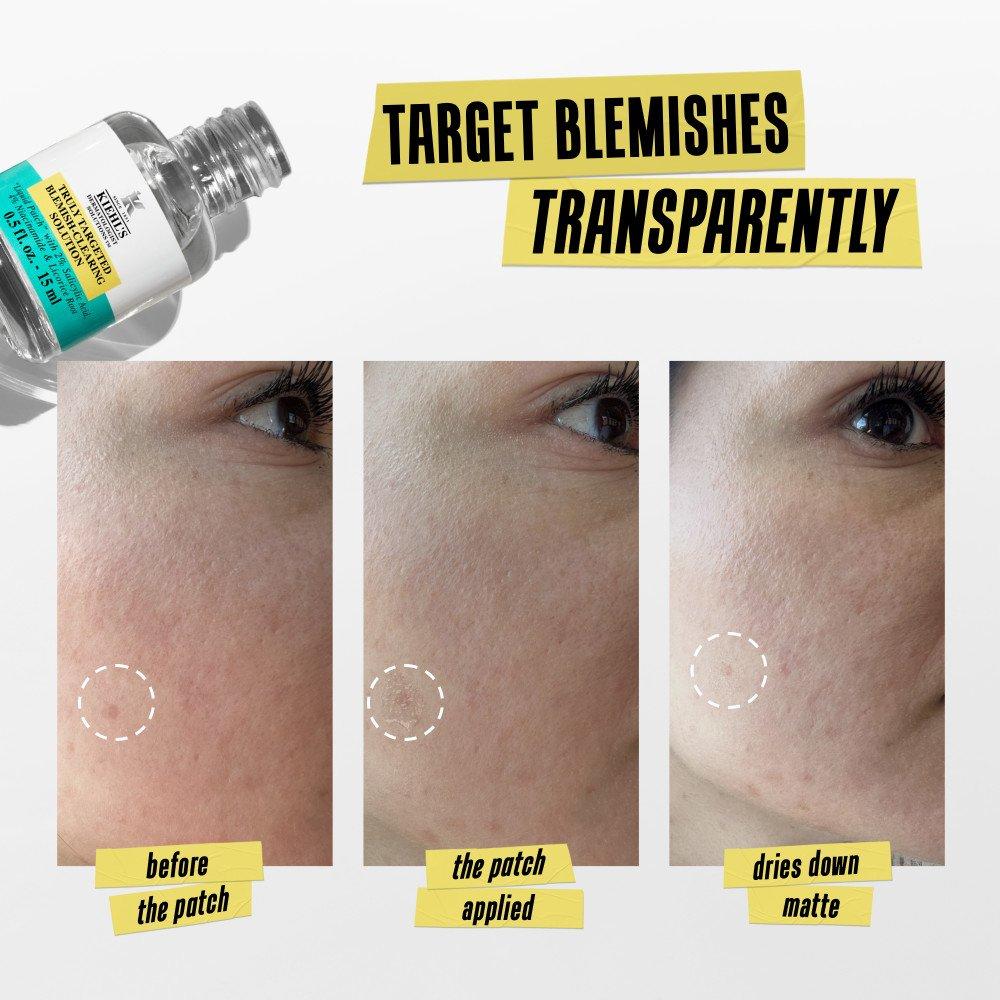 Clear - Kiehls - Targeted Blemish-Clearing Solution - 4