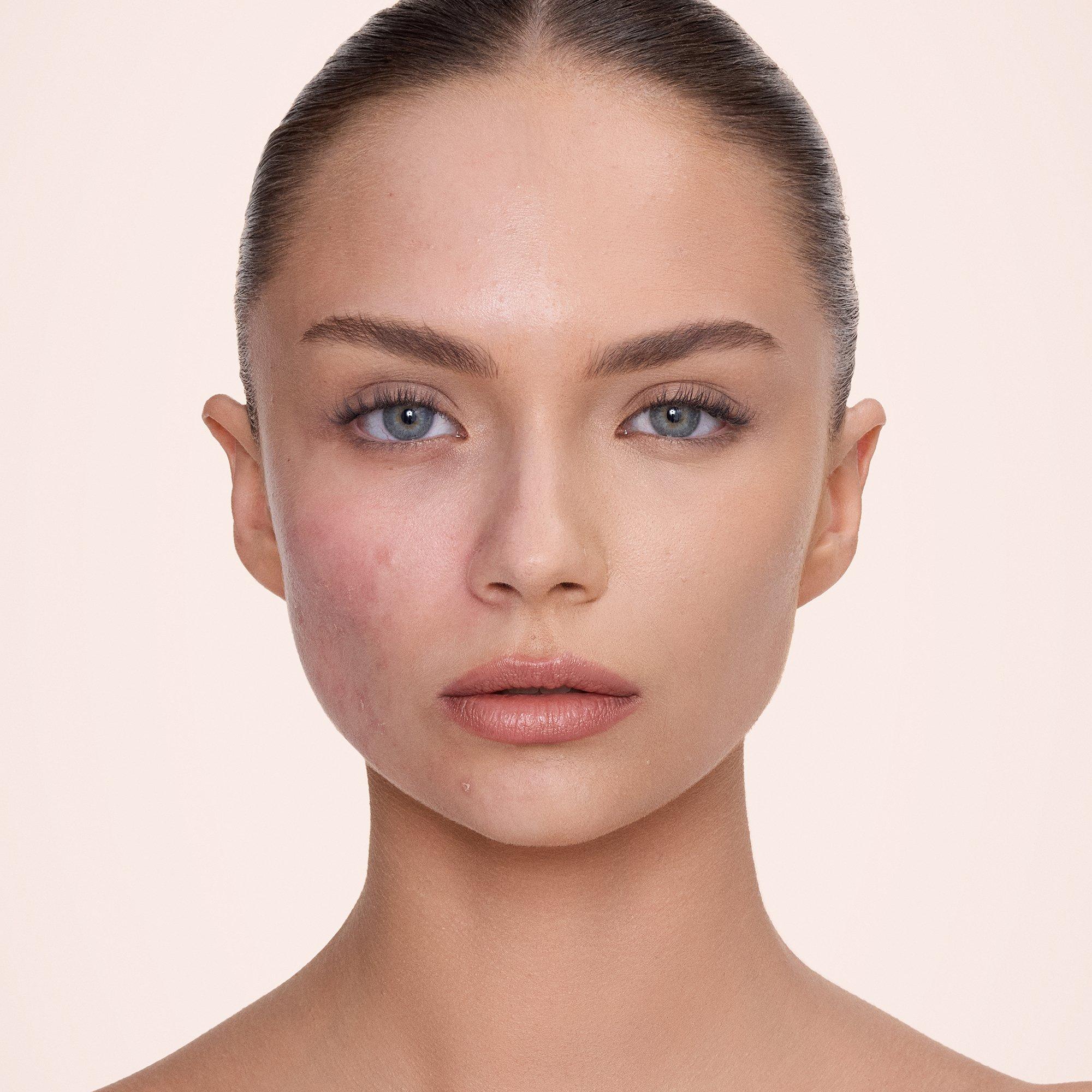 5 MEDIUM - Charlotte Tilbury - AIRbrush Flawless Blur Concealer - 2