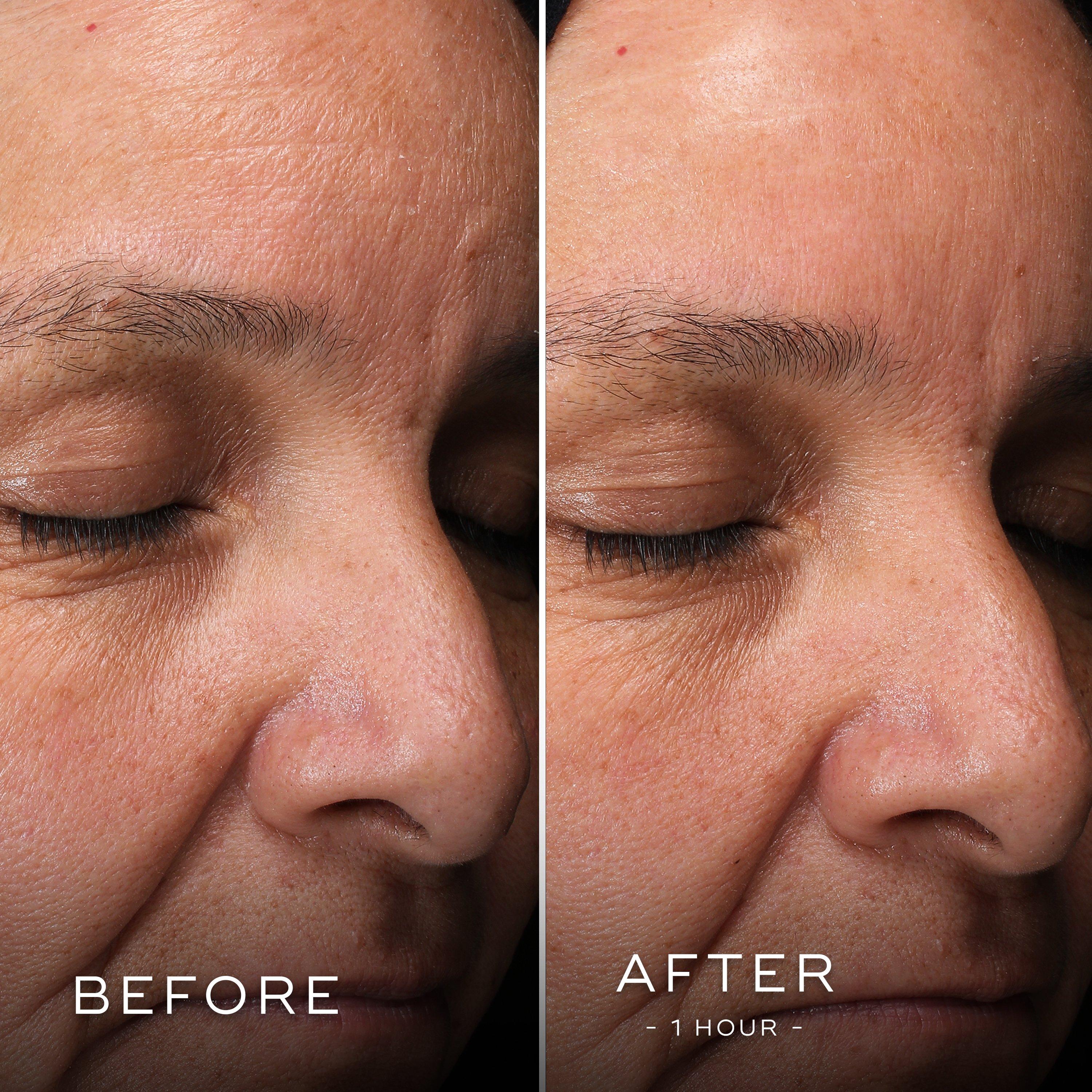 Clear - Medik8 - HEO Mask - 7