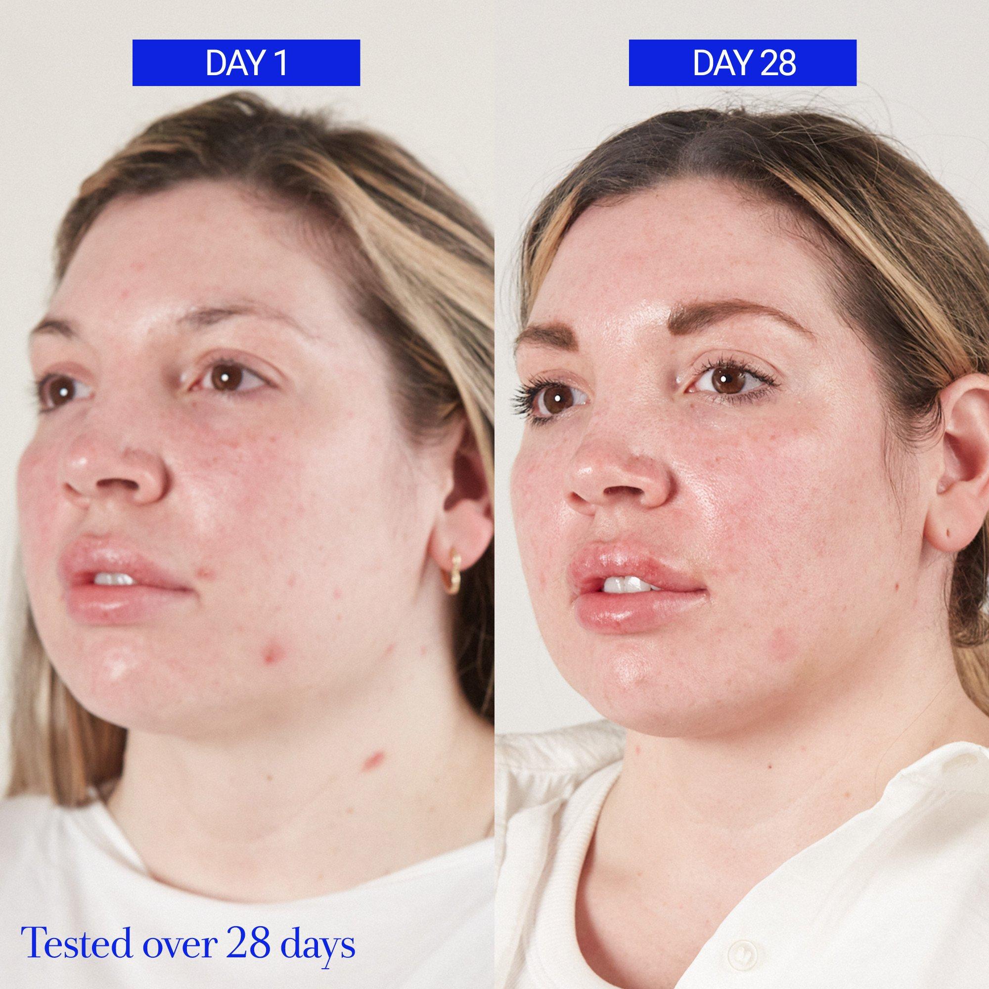 Clear - FRESH - Fresh Floral Recovery Calming Mask 100ml - 6