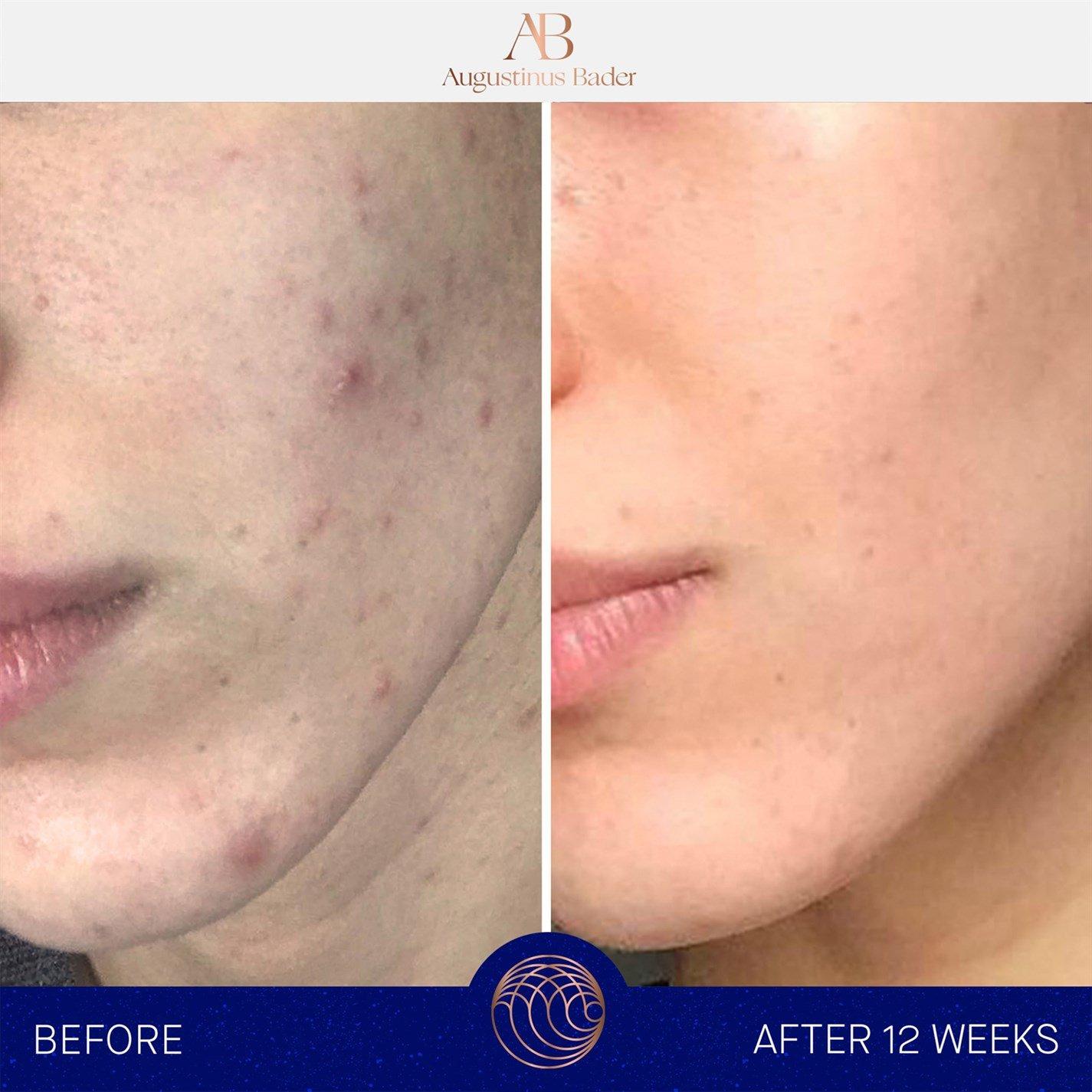 Cream - Augustinus Bader - The Cream - 9