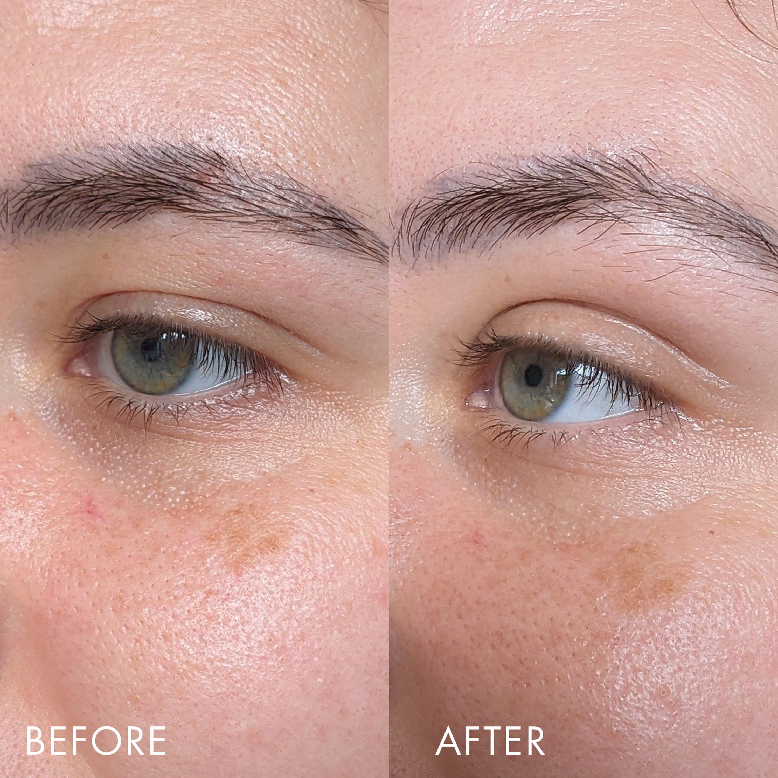 Clear - Eve Lom - Time Retreat Smoothing Eye Complex - 3