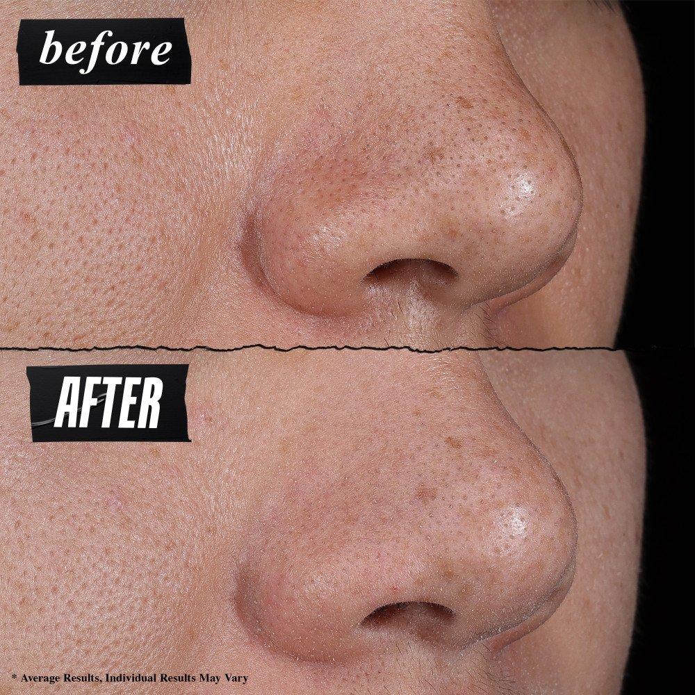 Clear - Kiehls - Kiehls RARE EARTH MASK - 6