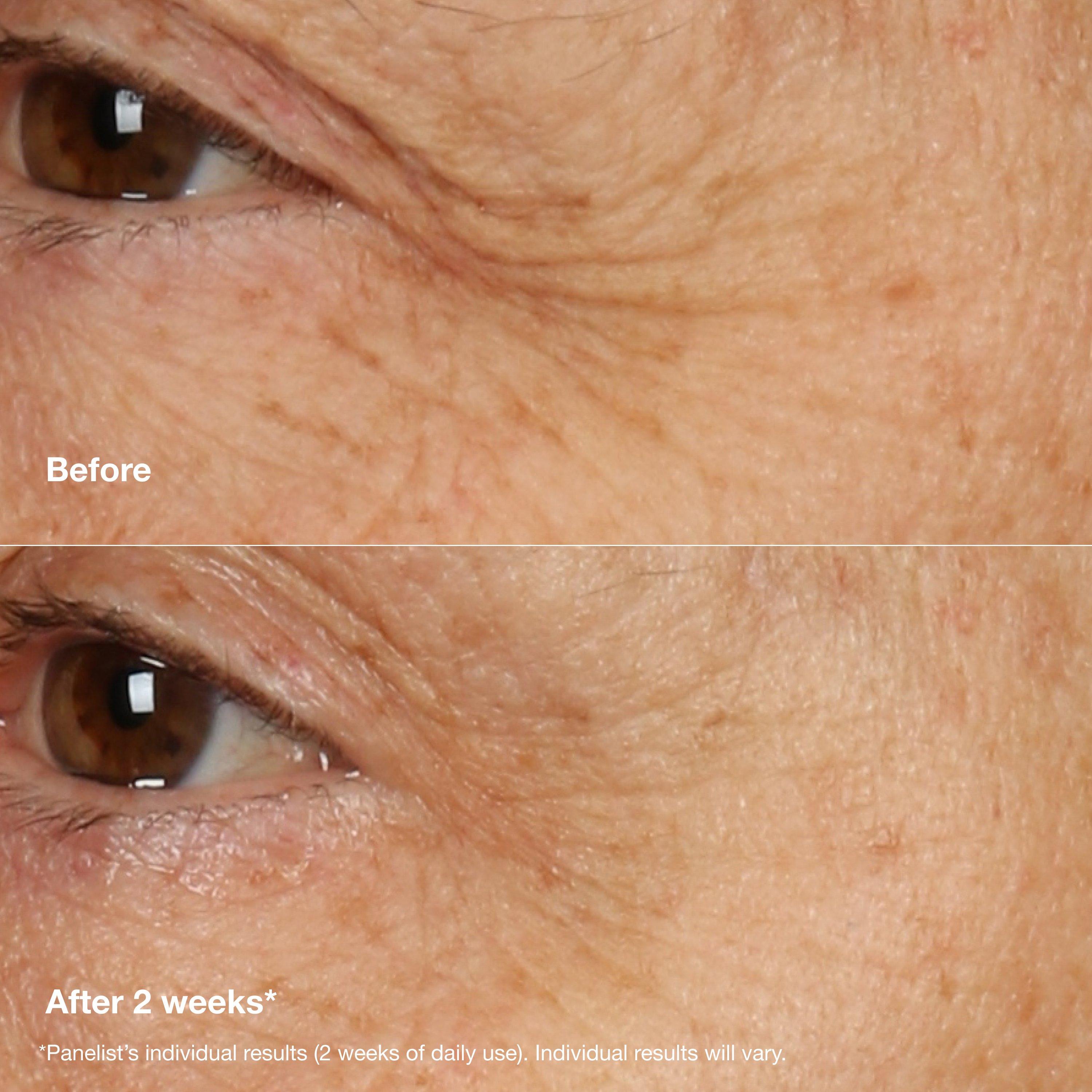 None - Clinique - Clinique Smart Clinical Repair™ Overnight Recovery Cream + Mask - 4