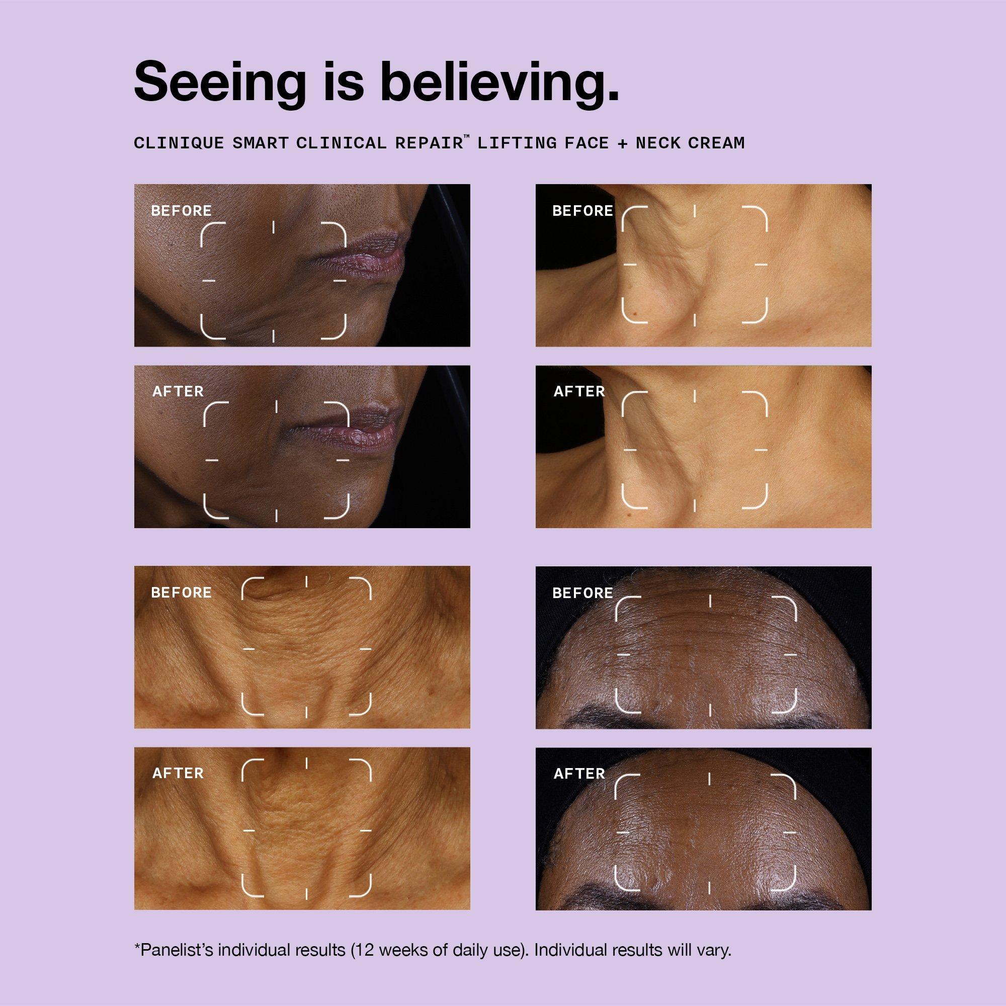 Clear - Clinique - Clinique Smart Clinical Repair™ Lifting Face + Neck Cream - 2