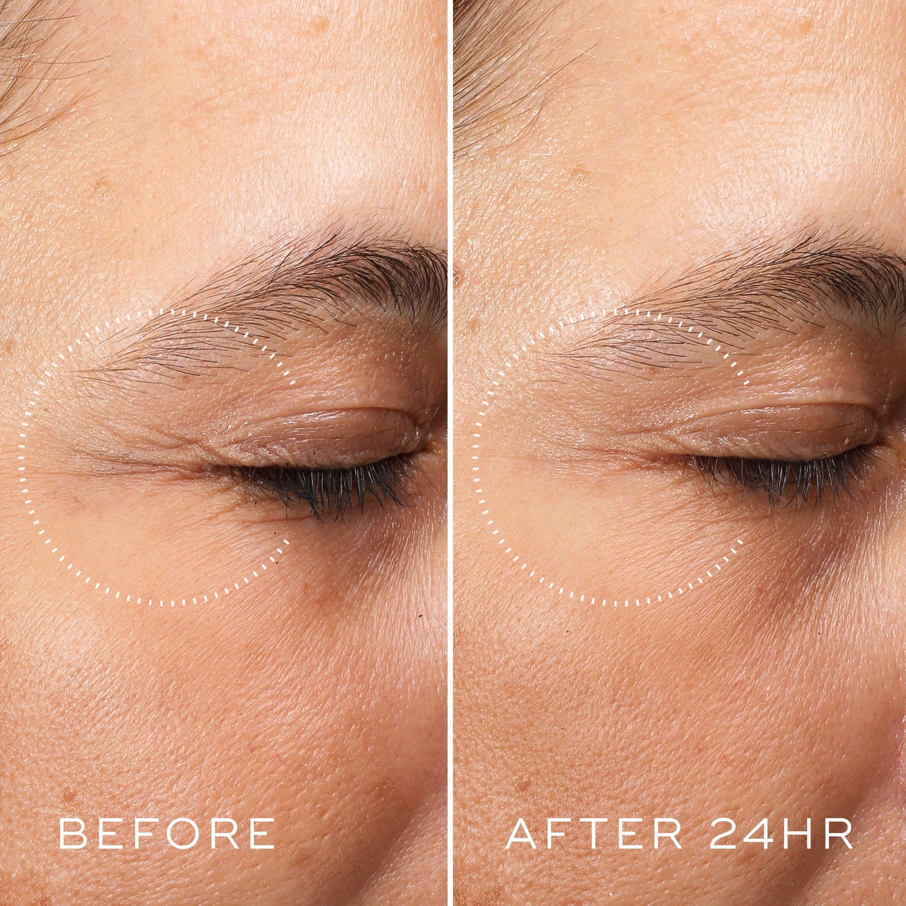 Clear - Medik8 - Crystal Retinal Ceramide Eye 6 - 7