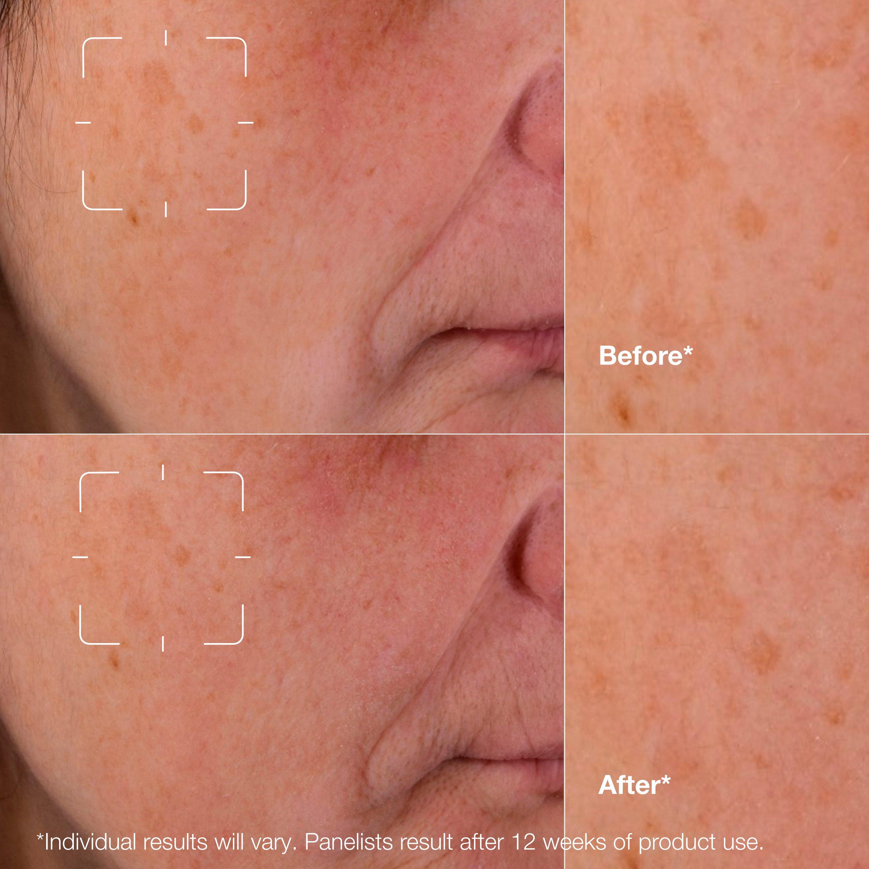 Clear - Clinique - Even Better Clinical™ Dark Spot Clearing Serum - 4