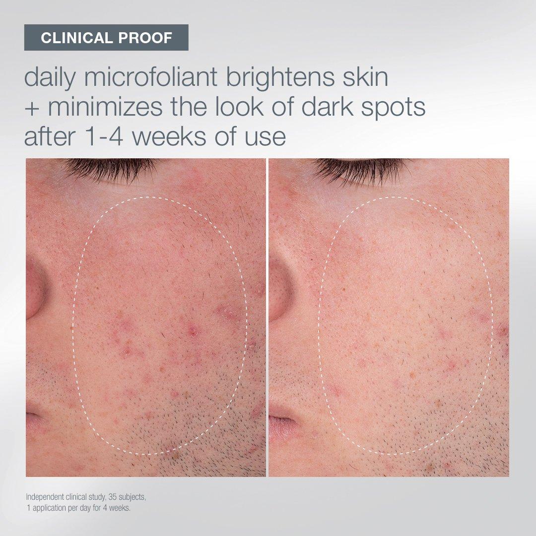 Clear - Dermalogica - DERM The First Snow 62 - 5