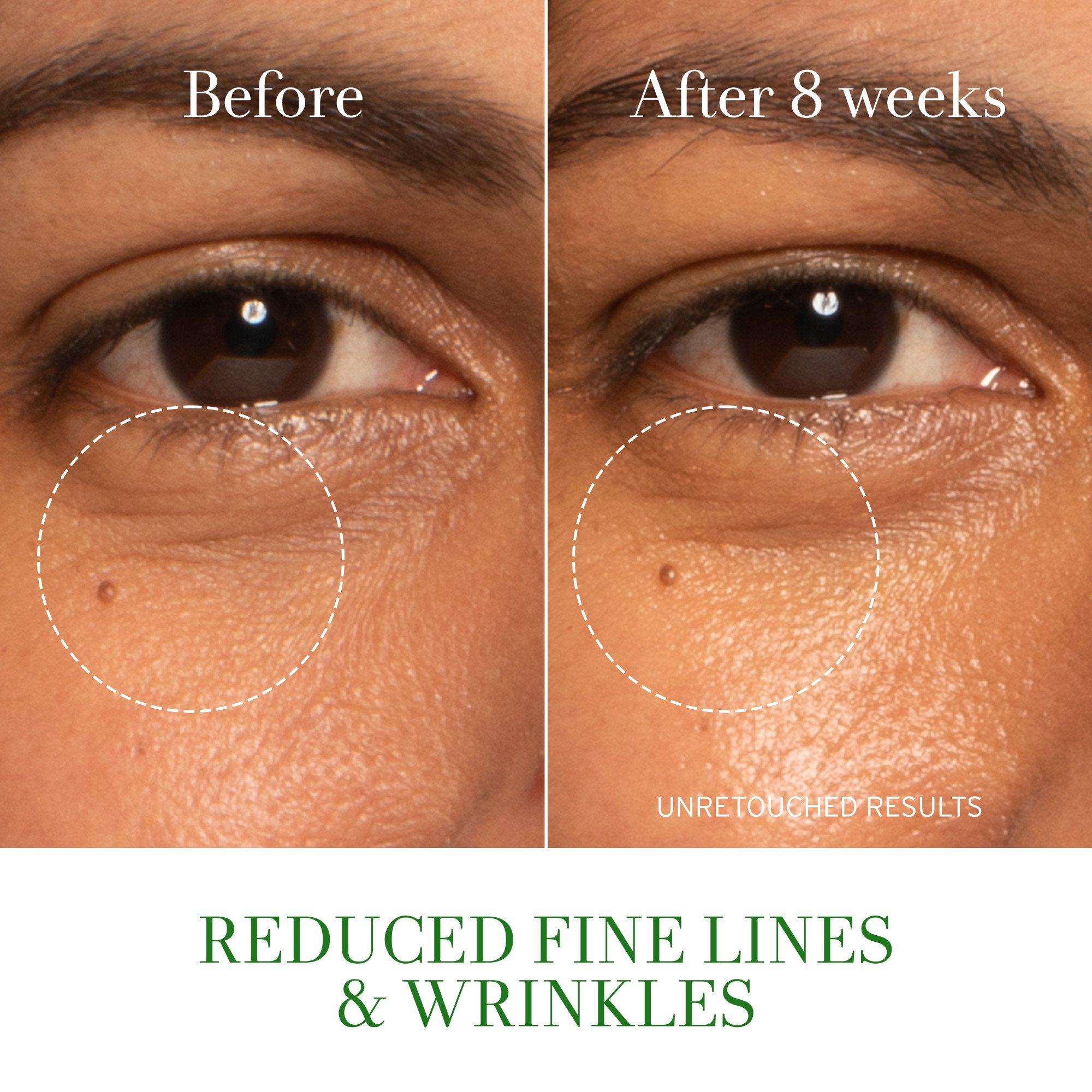 Clear - FRESH - Fresh Tea Elixir Skin Resilience Activating Serum - 10