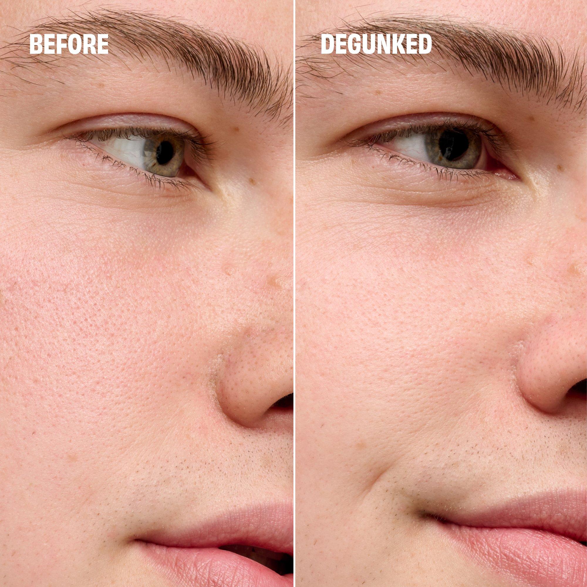 Clear - Benefit - POREfessional Degunker Blackhead & Pore Cleansing Tool - 4