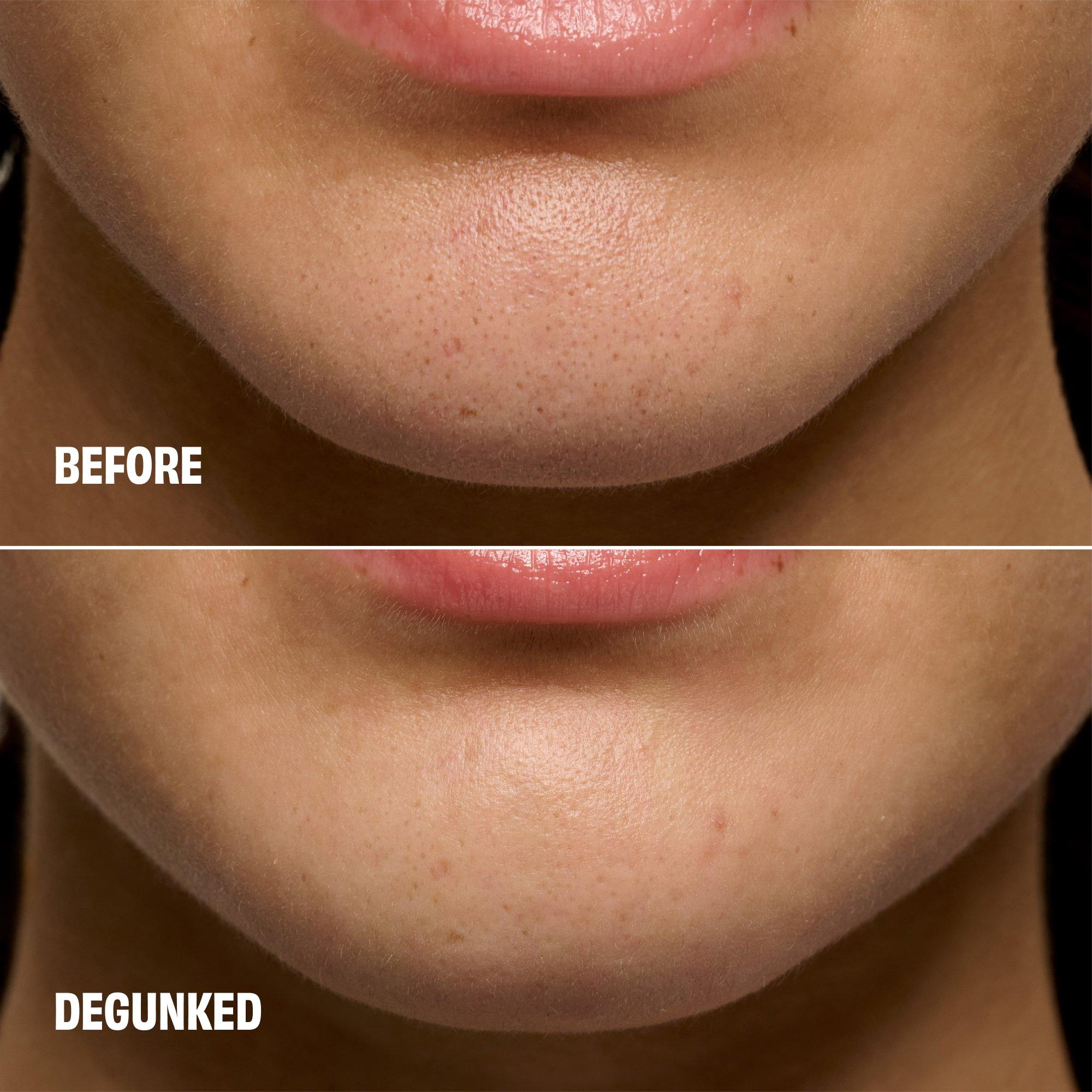 Clear - Benefit - POREfessional Degunker Blackhead & Pore Cleansing Tool - 5