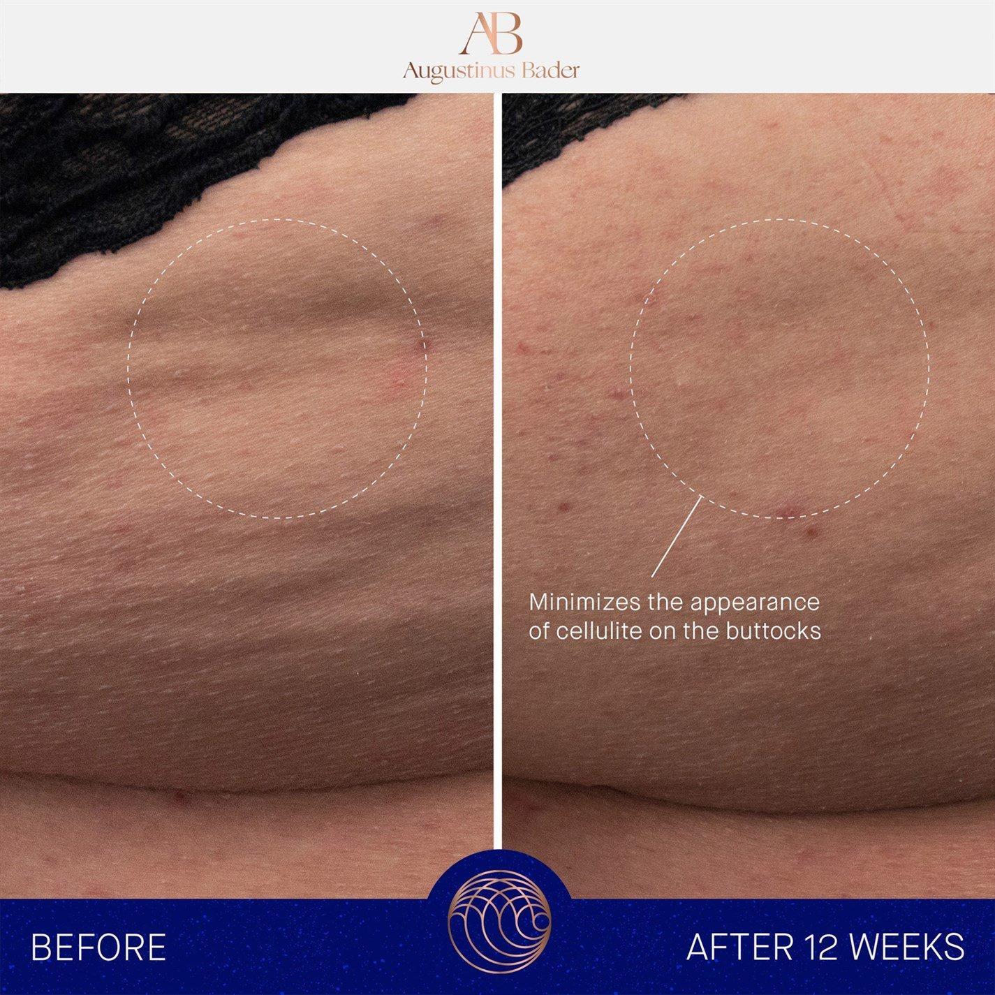 Cream - Augustinus Bader - The Body Cream - 6