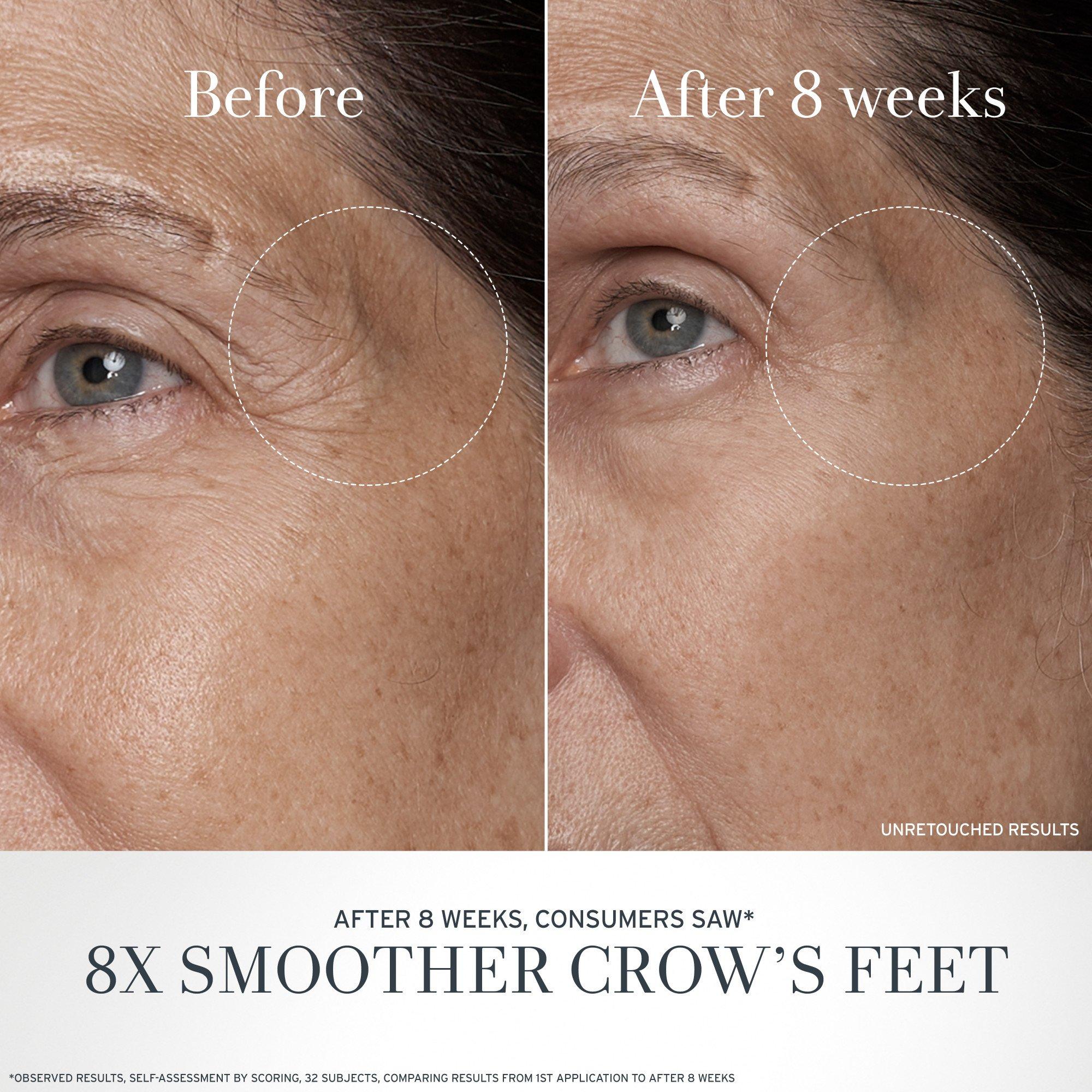 Clear - FRESH - Black Tea Age Renewal Anti-Aging Eye Cream 15ml - 7