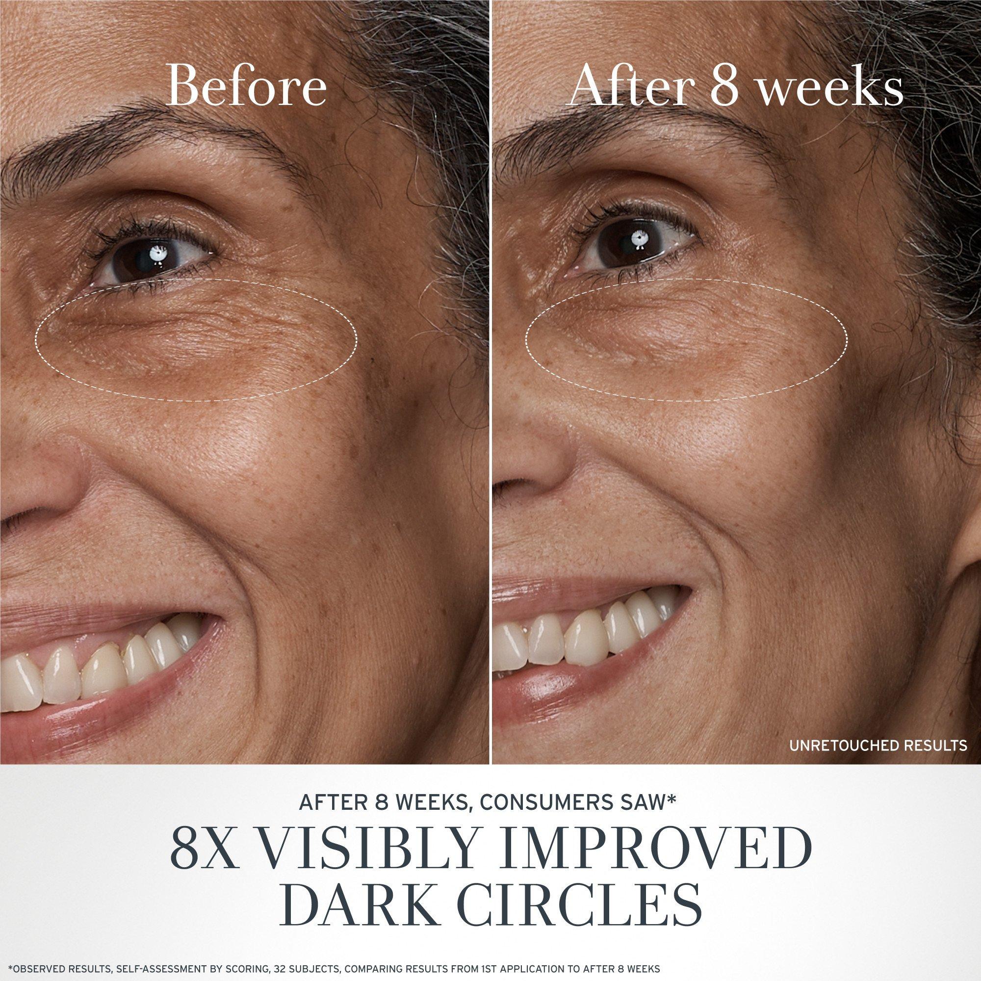 Clear - FRESH - Black Tea Age Renewal Anti-Aging Eye Cream 15ml - 8