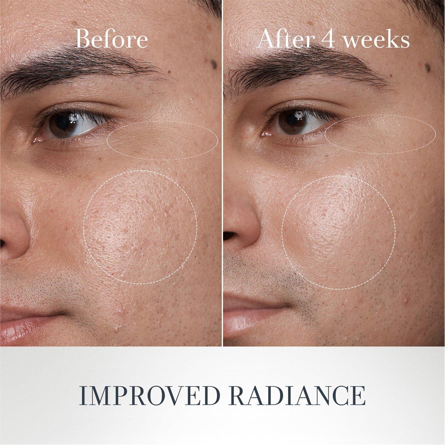 Clear - FRESH - Fresh Lotus Youth Preserve Dream Face Cream - 8