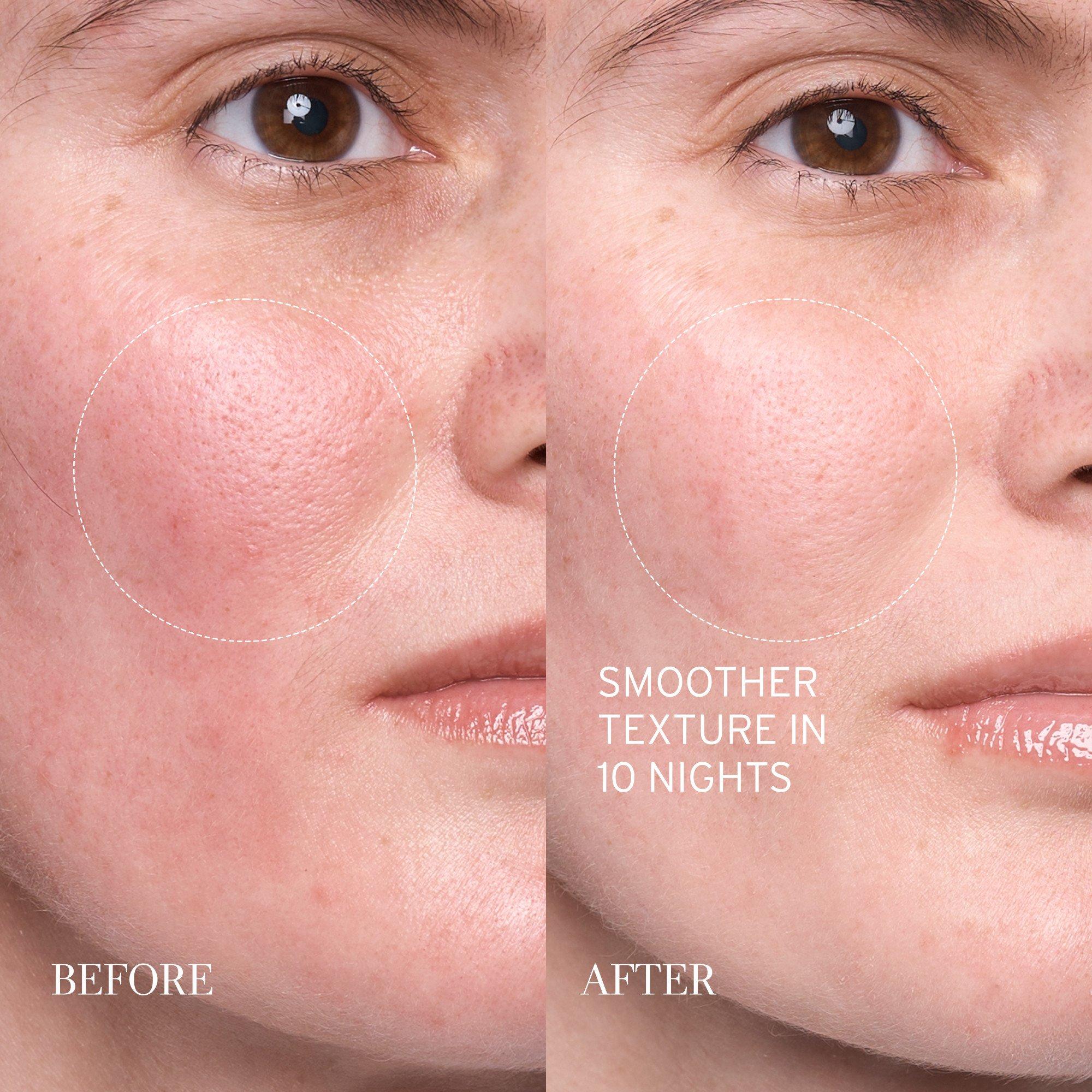 Clear - FRESH - Fresh Lotus Youth Preserve Resurfacing Dream Serum 30ml - 5