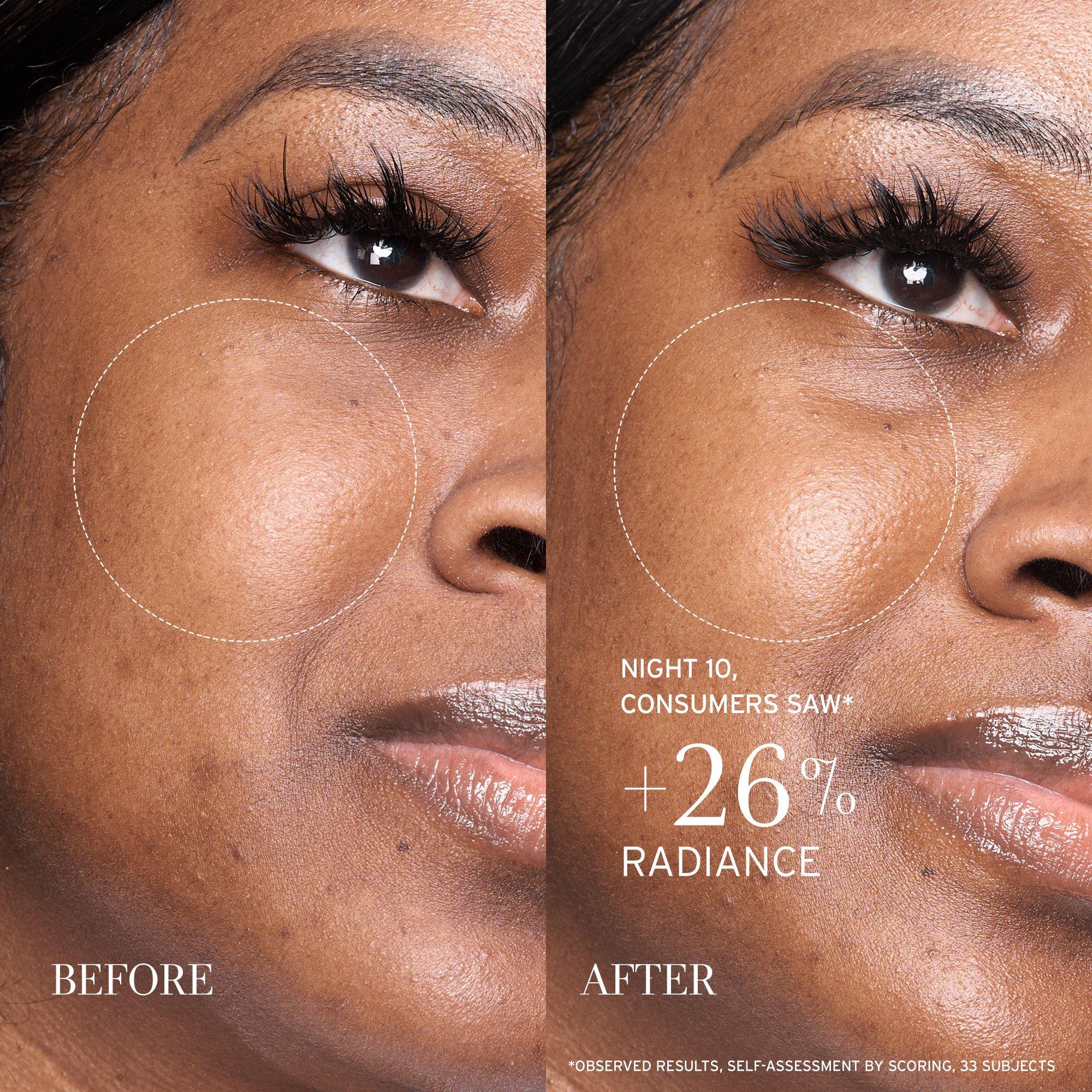 Clear - FRESH - Fresh Lotus Youth Preserve Resurfacing Dream Serum 30ml - 6