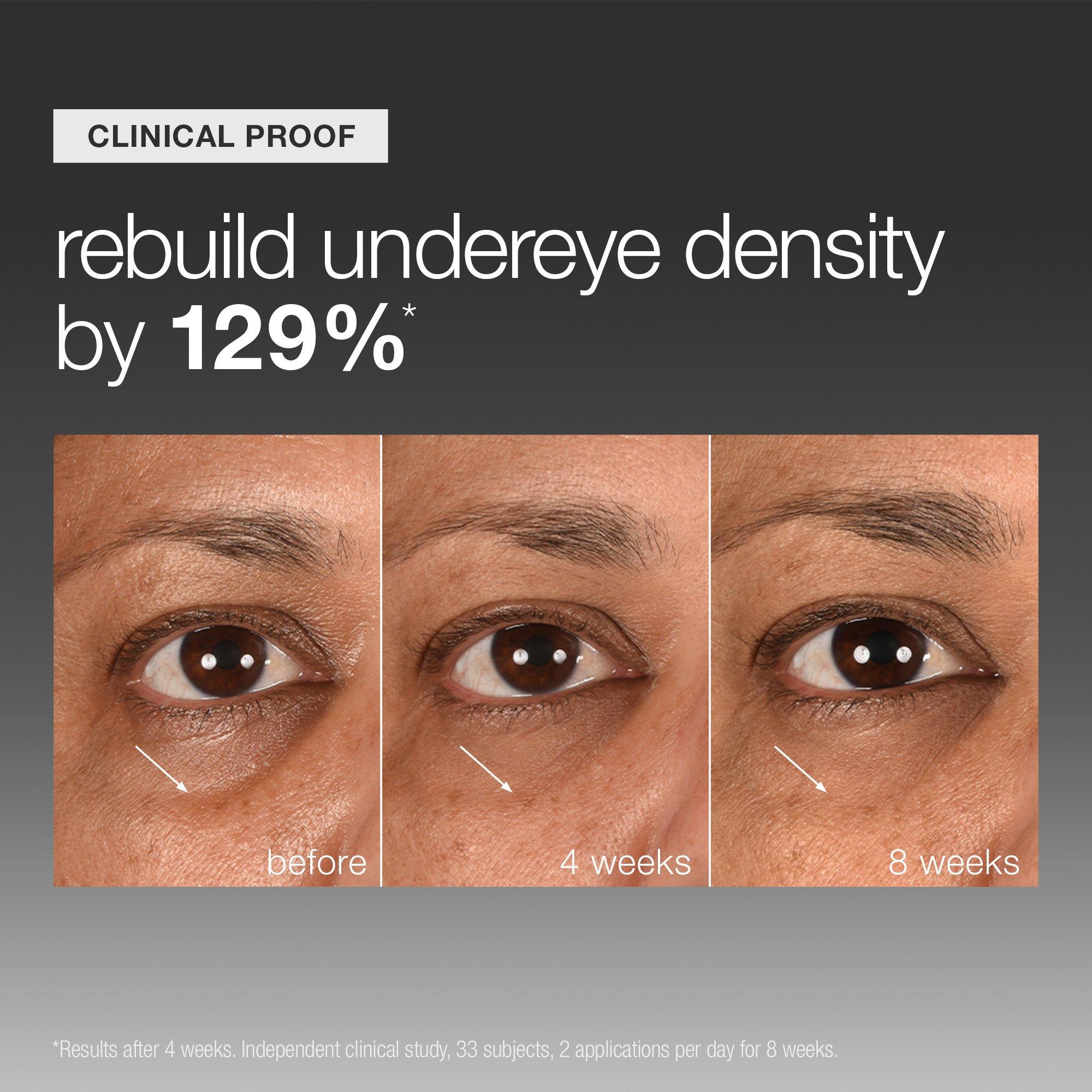 None - Dermalogica - DERM Smart Eye Density 00 - 4