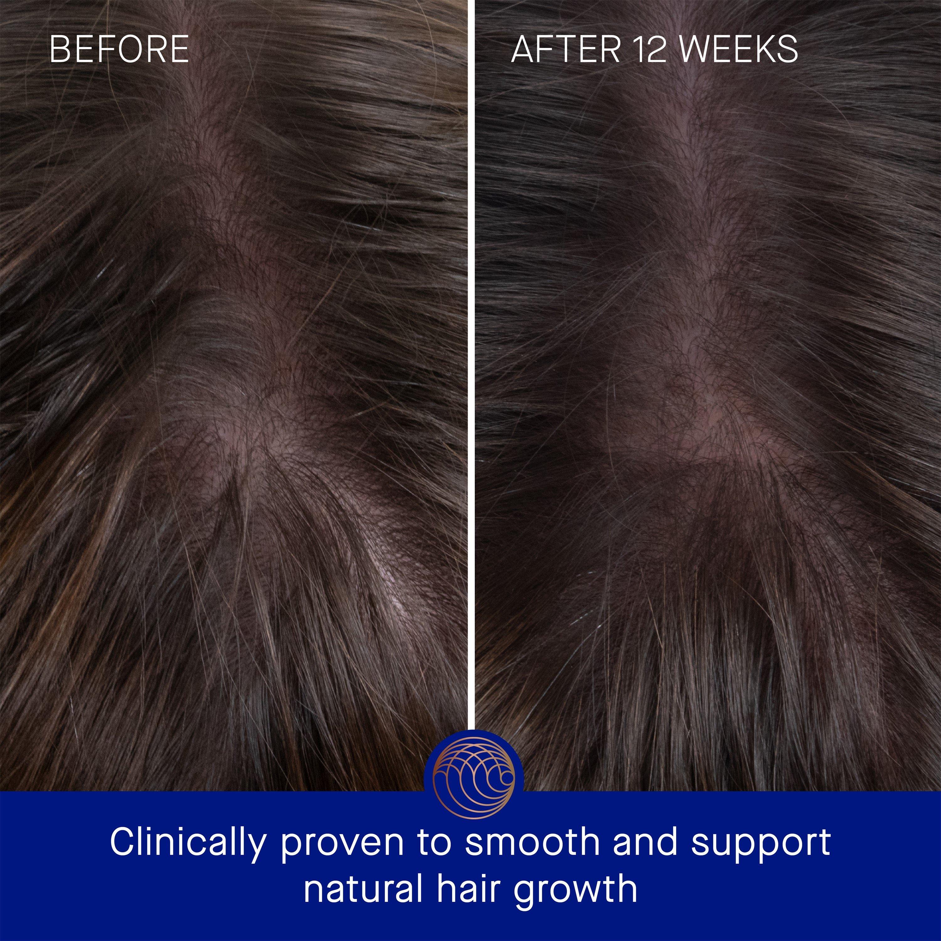 Clear - Augustinus Bader - The Hair Oil - 5