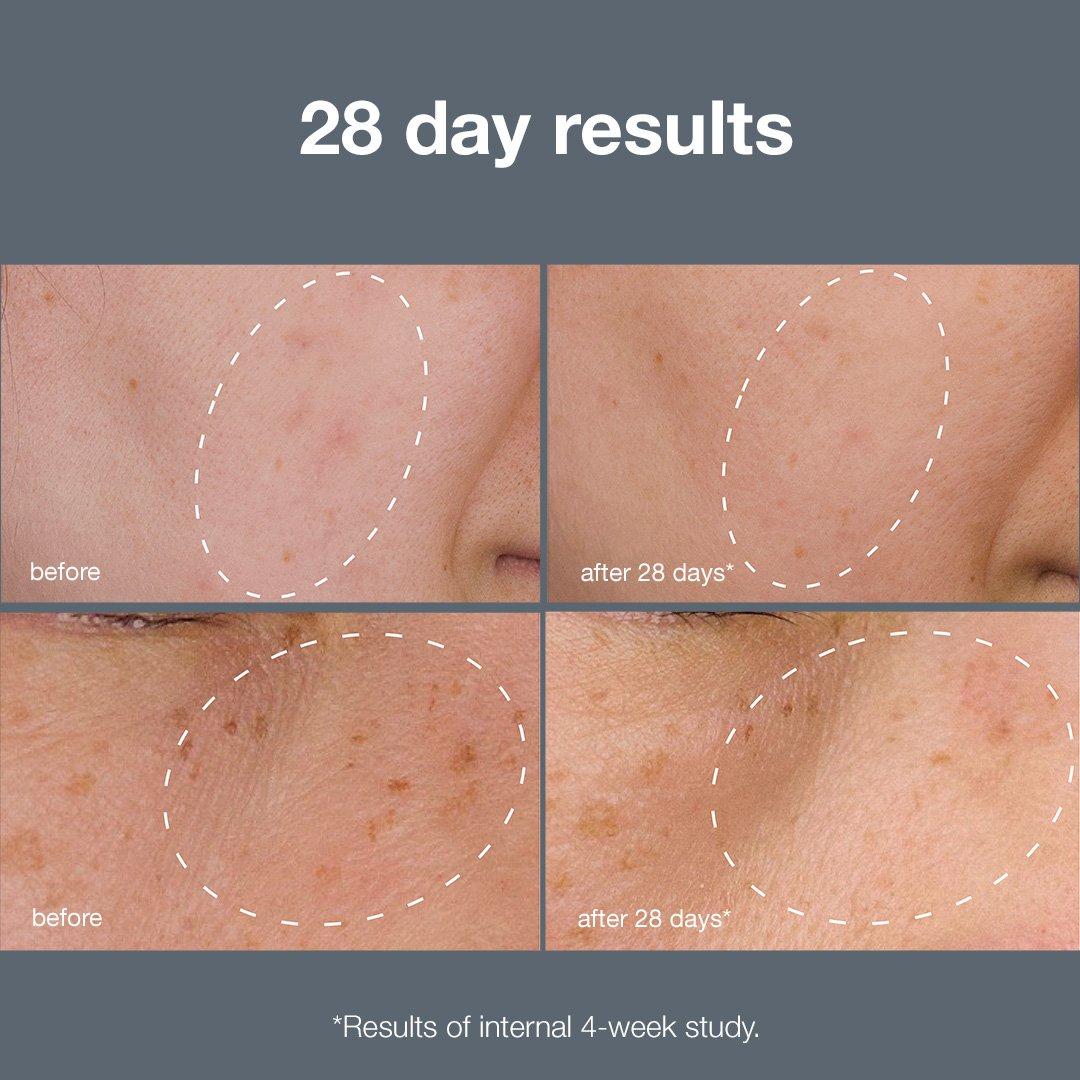 Clear - Dermalogica - Powerbright Dark Spot System - 5