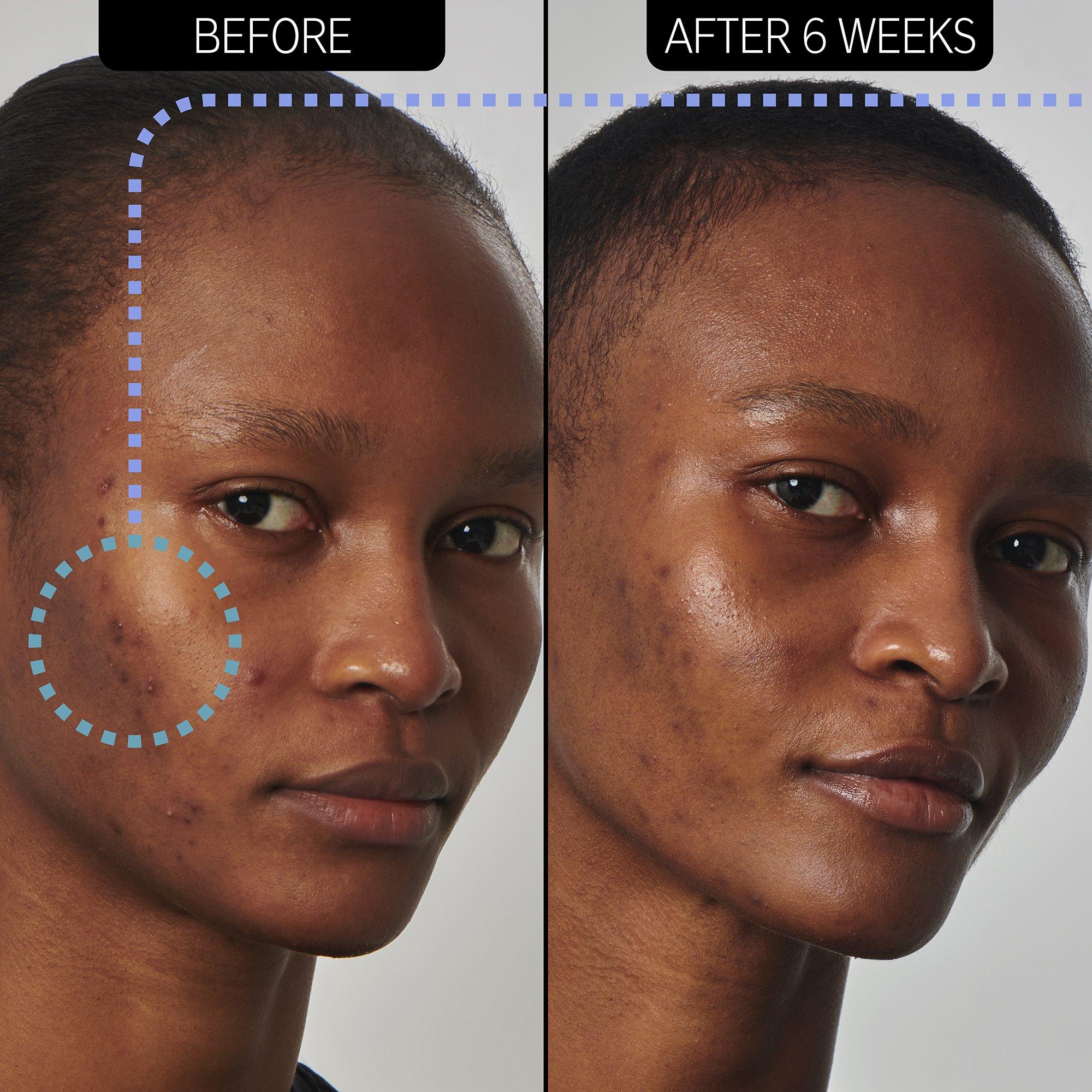 Clear - The Inkey List - Inkey Super Solutions Niacinamide Serum - 4