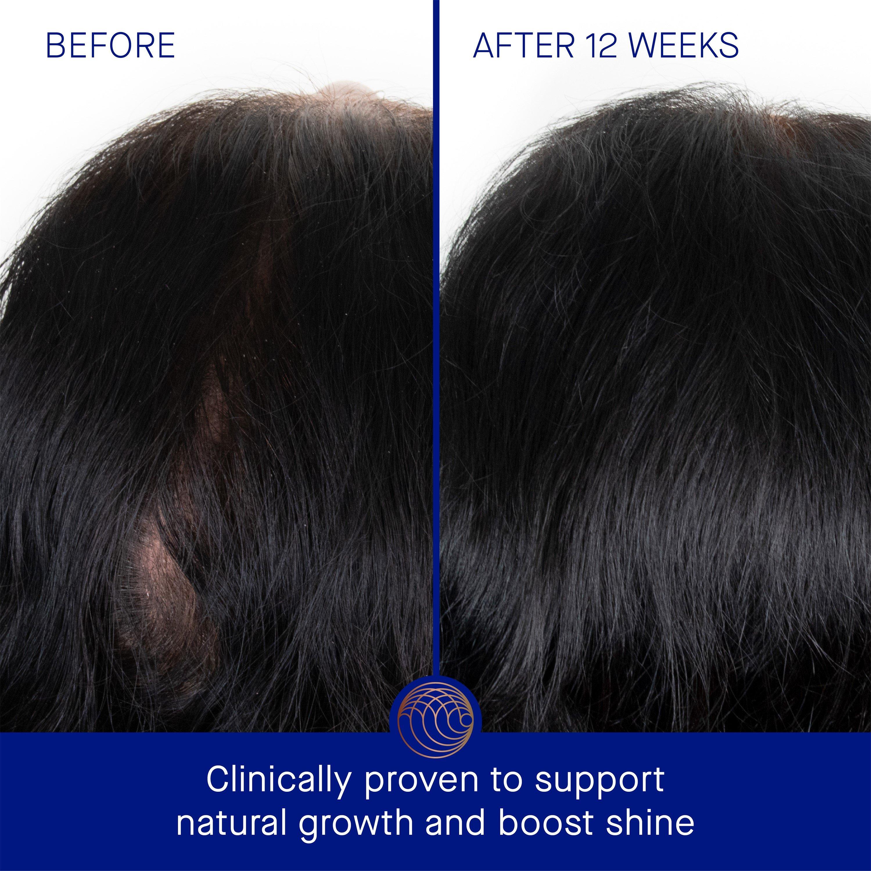 Clear - Augustinus Bader - The Scalp Treatment - 5